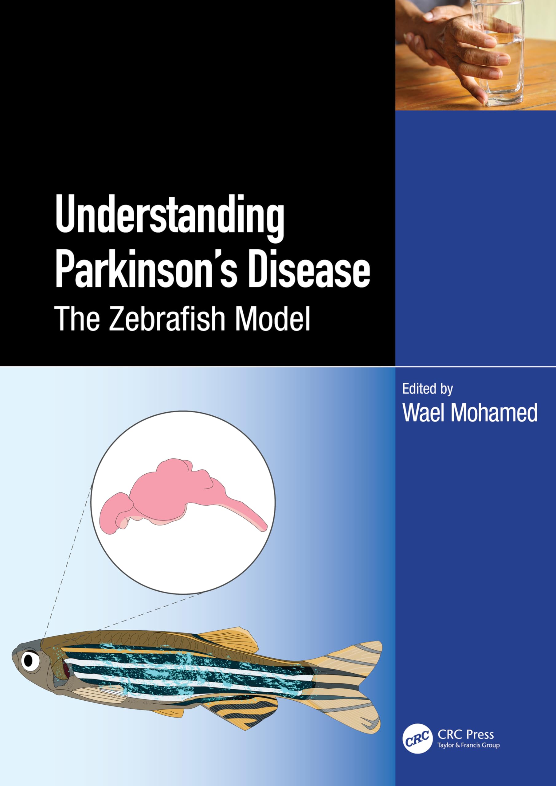Zebrafish As a Model for Parkinson’s Disease Medicine