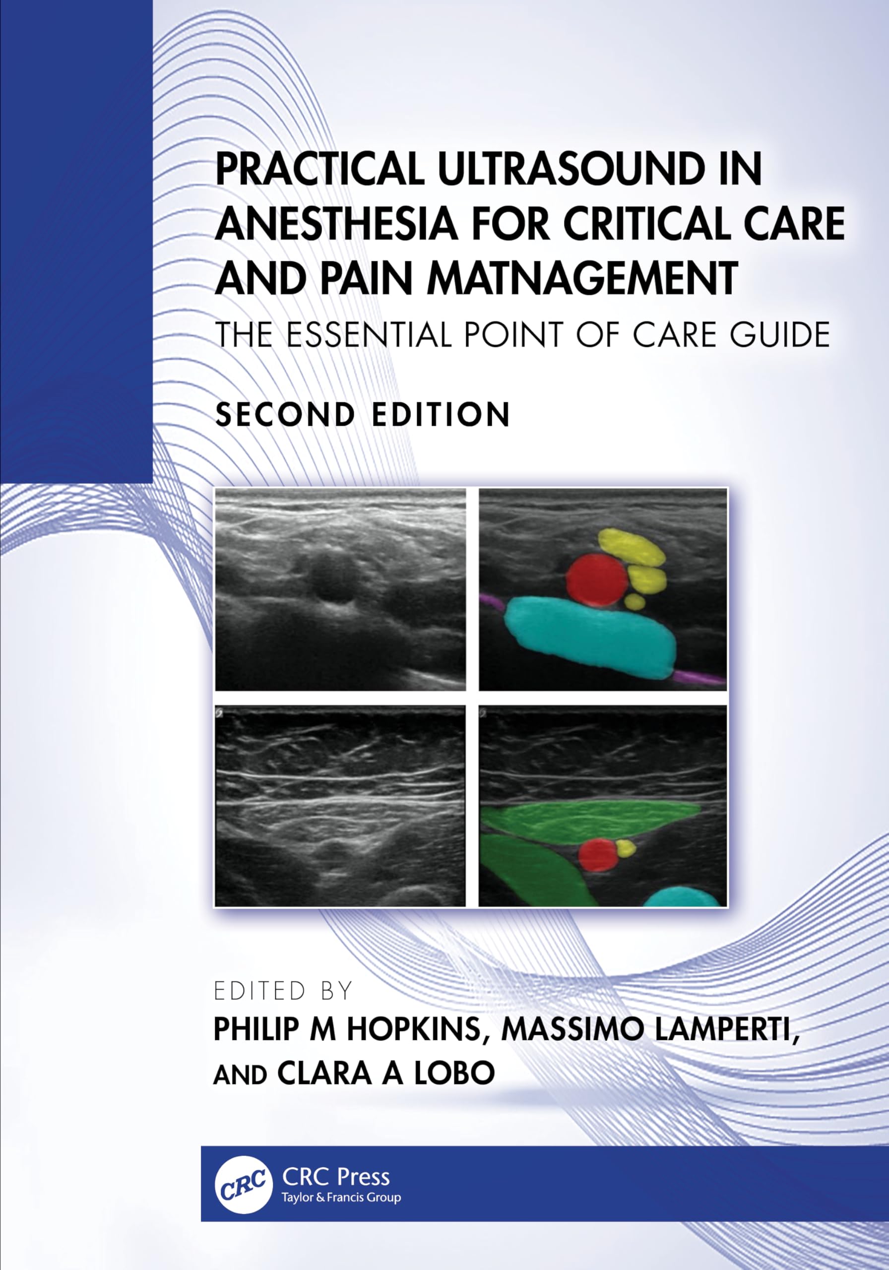 Practical Ultrasound in Anesthesia for Critical Care and Pain Management: The Essential Point of Care Guide Medicine