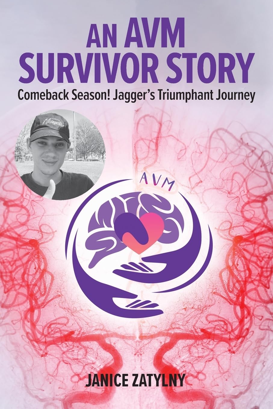 An AVM Survival Story Science
