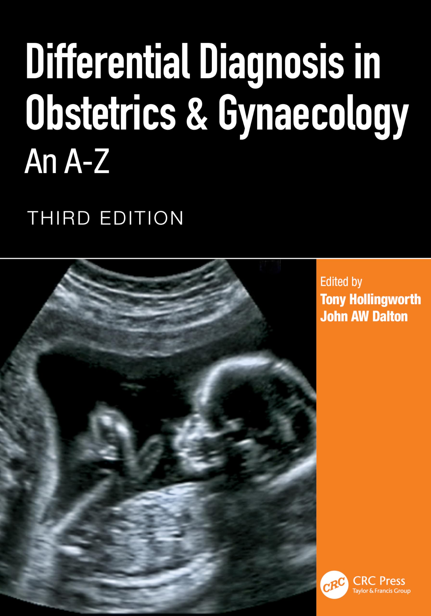Differential Diagnosis in Obstetrics & Gynaecology Medicine