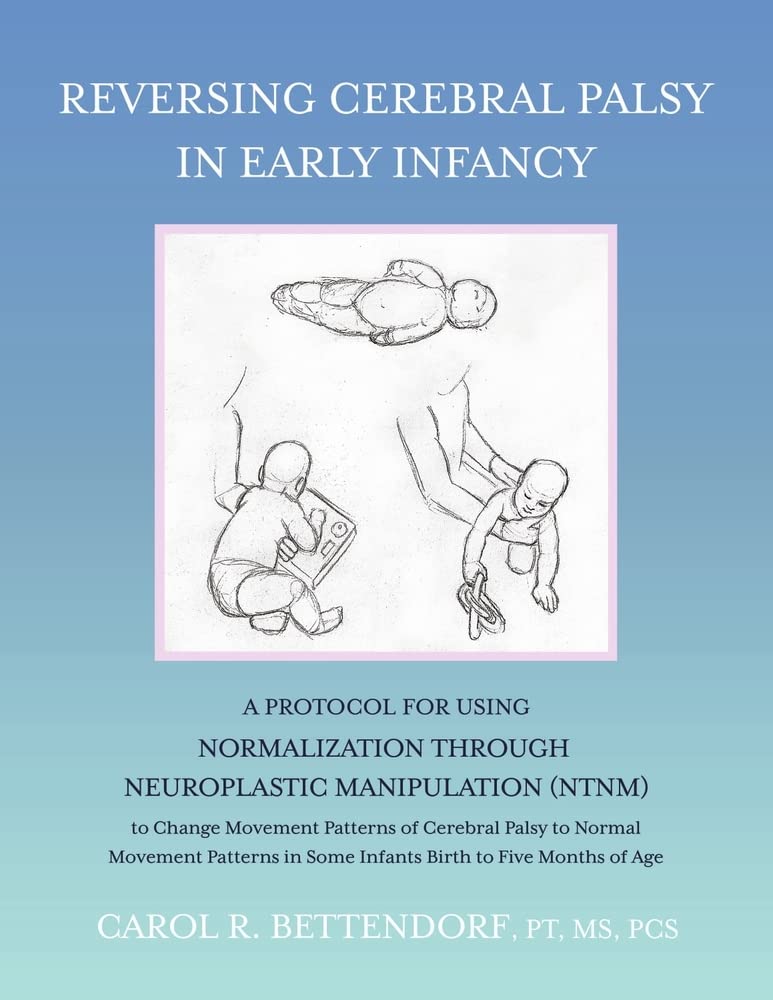 Reversing Cerebral Palsy in Early Infancy: A Protocol for Using Normalization Through Neuroplastic Manipulation Study Guides