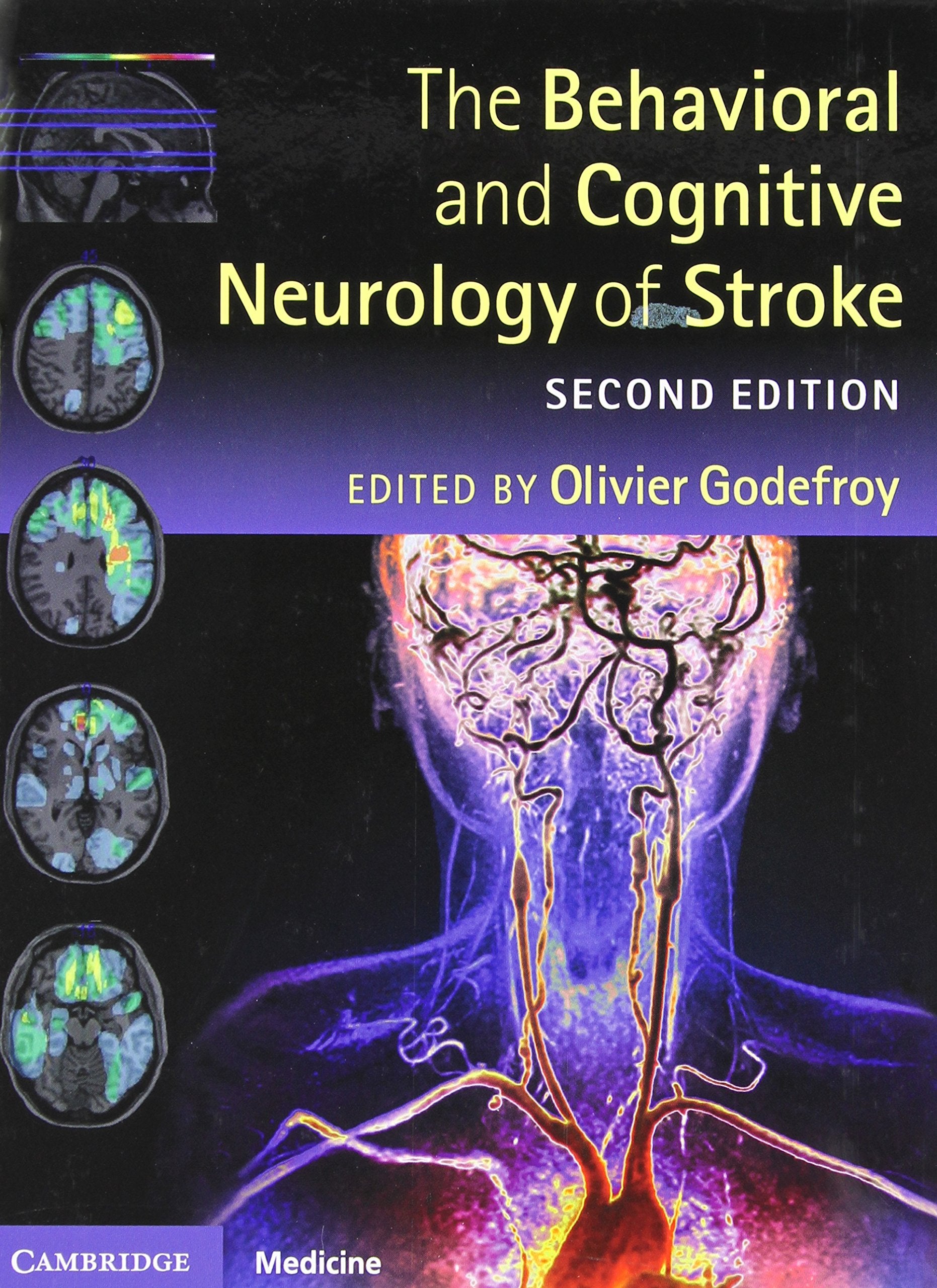 The Behavioral and Cognitive Neurology of Stroke book