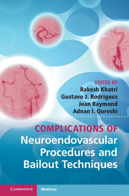 Complications of Neuroendovascular Procedures and Bailout Techniques Medicine