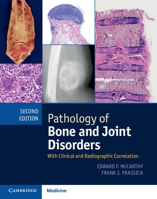 Pathology of Bone and Joint Disorders Print and Online Bundle: With Clinical and Radiographic Correlation book