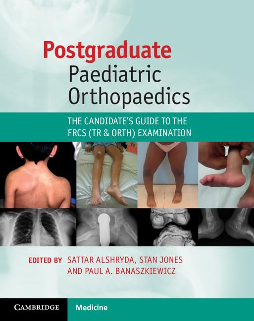 Postgraduate Paediatric Orthopaedics: The Candidates Guide to the Frcs Tr & Orth Examination Medicine
