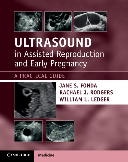 Ultrasound in Assisted Reproduction and Early Pregnancy: A Practical Guide Medicine