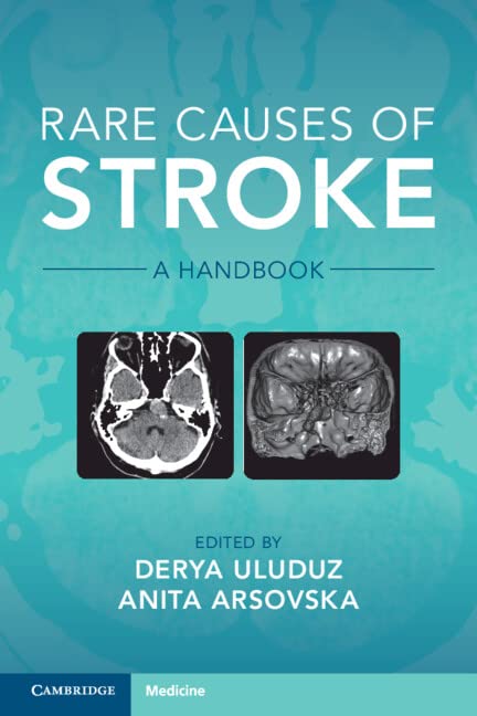 Rare Causes of Stroke: A Handbook Medicine