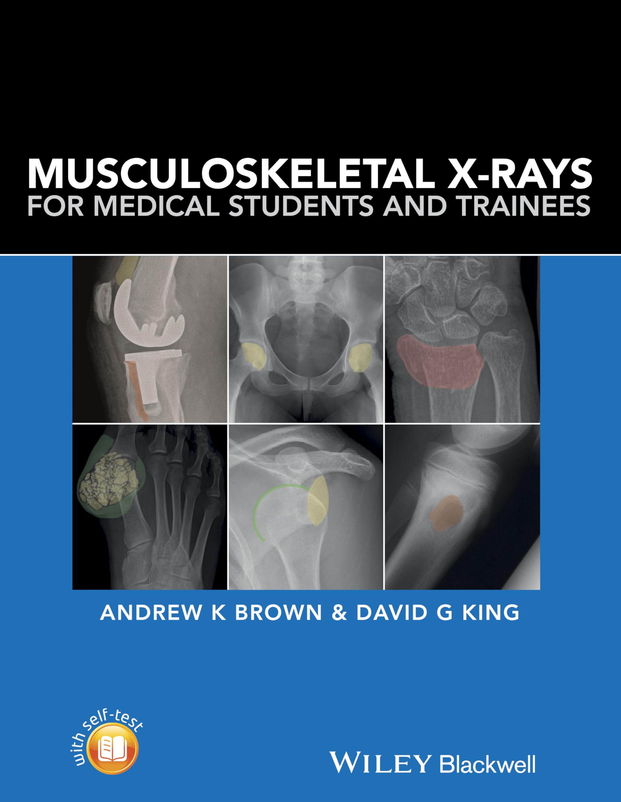 Musculoskeletal X-Rays for Medical Students and Trainees Medicine