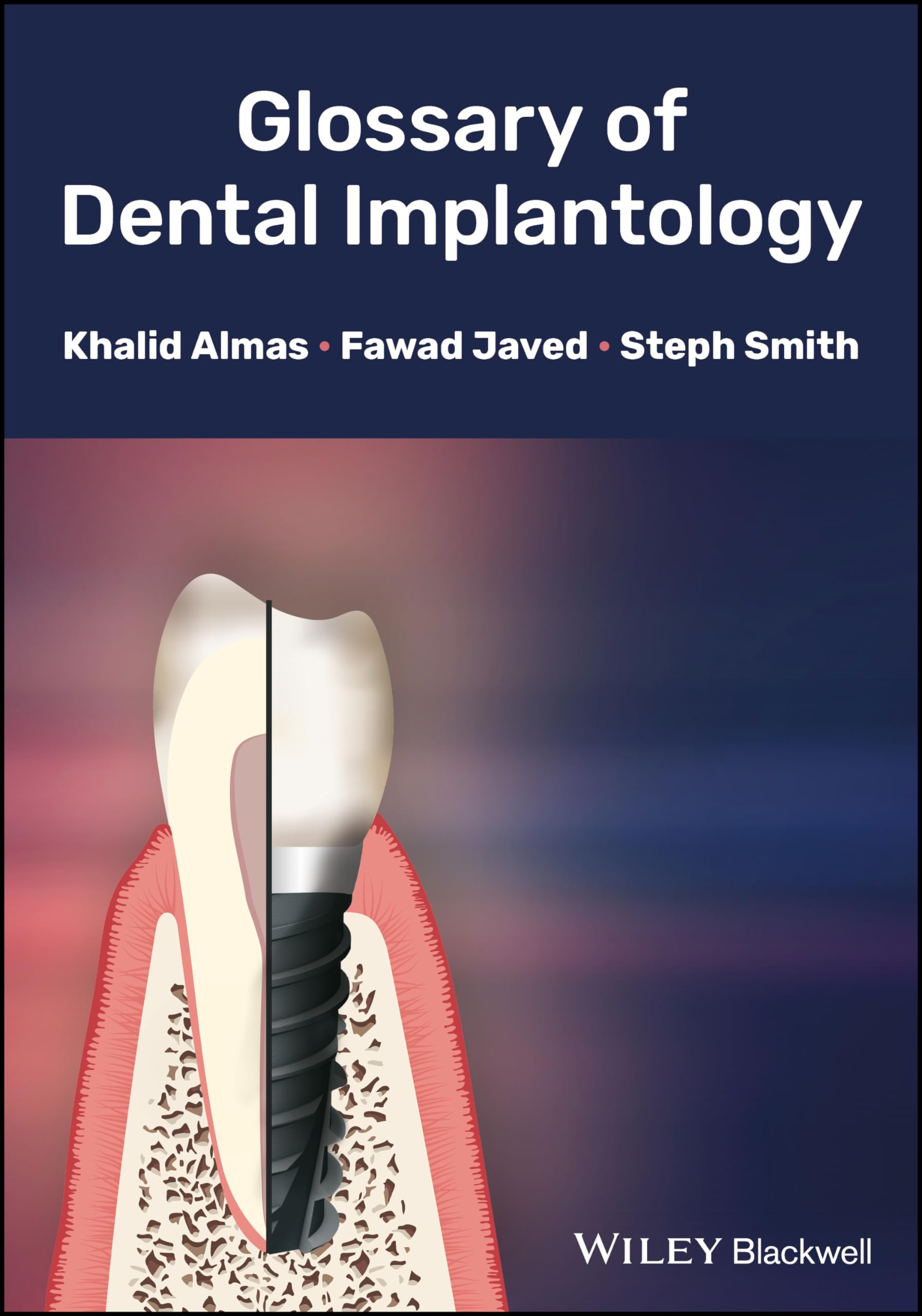 Glossary of Dental Implantology Medicine