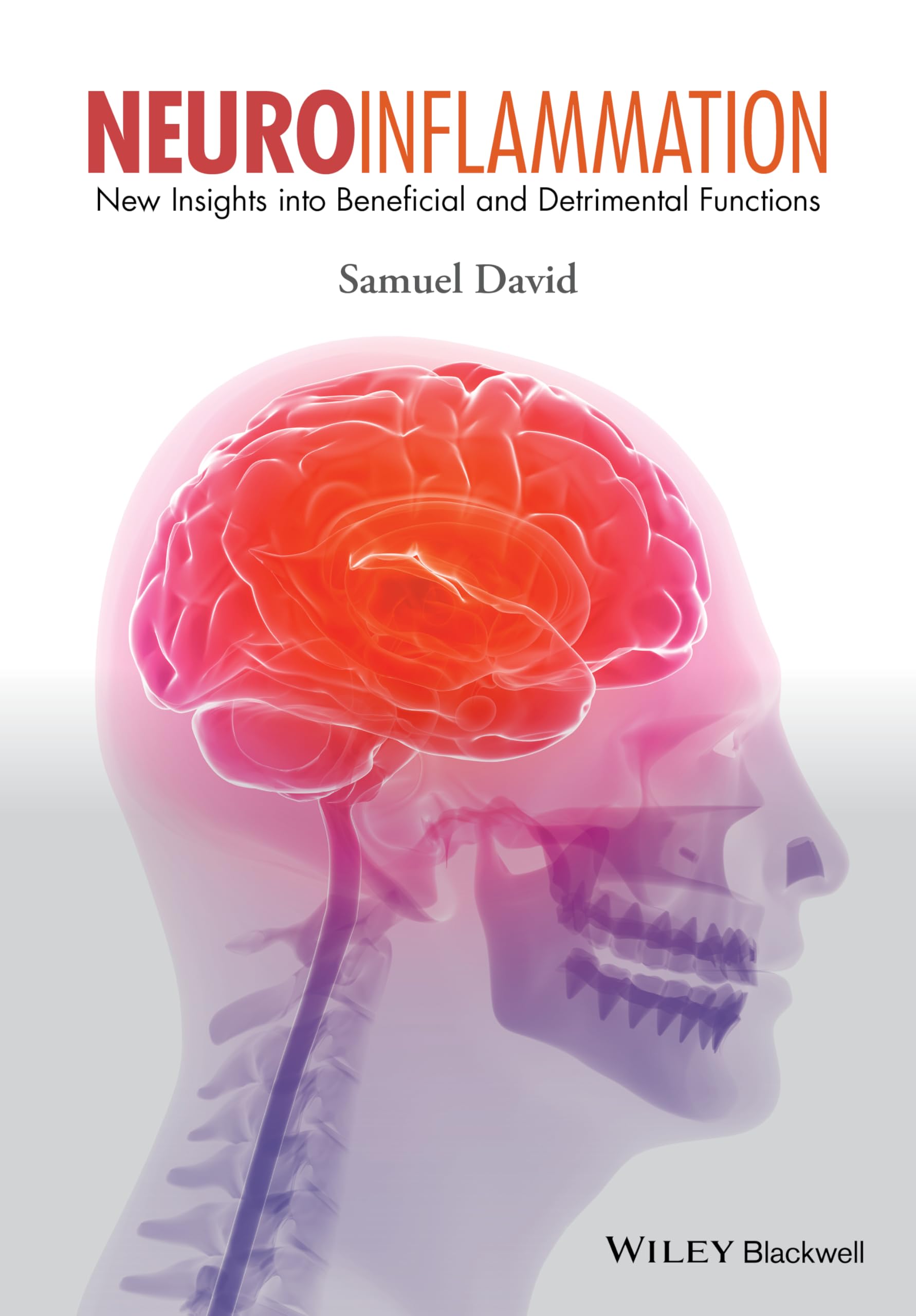 Neuroinflammation: New Insights into Beneficial and Detrimental Functions Medicine