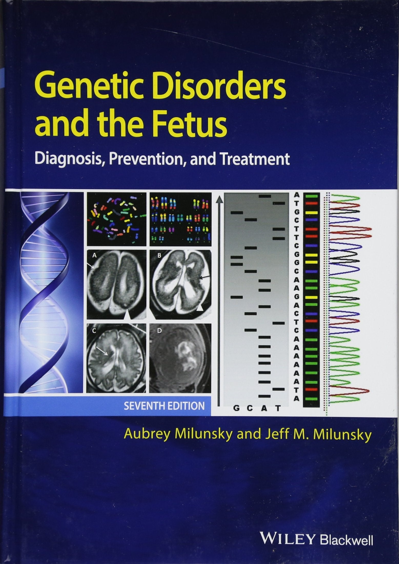 Genetic Disorders and the Fetus: Diagnosis, Prevention, and Treatment Medicine