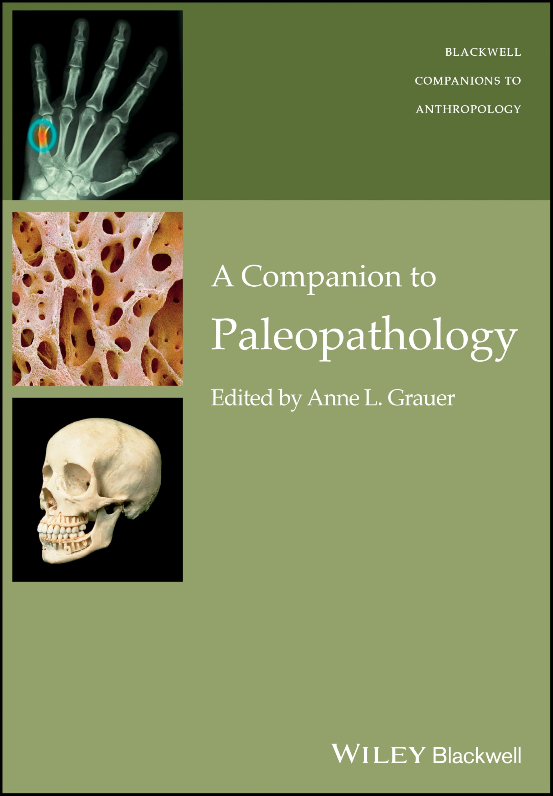 A Companion to Paleopathology (Wiley Blackwell Companions to Anthropology) Medicine