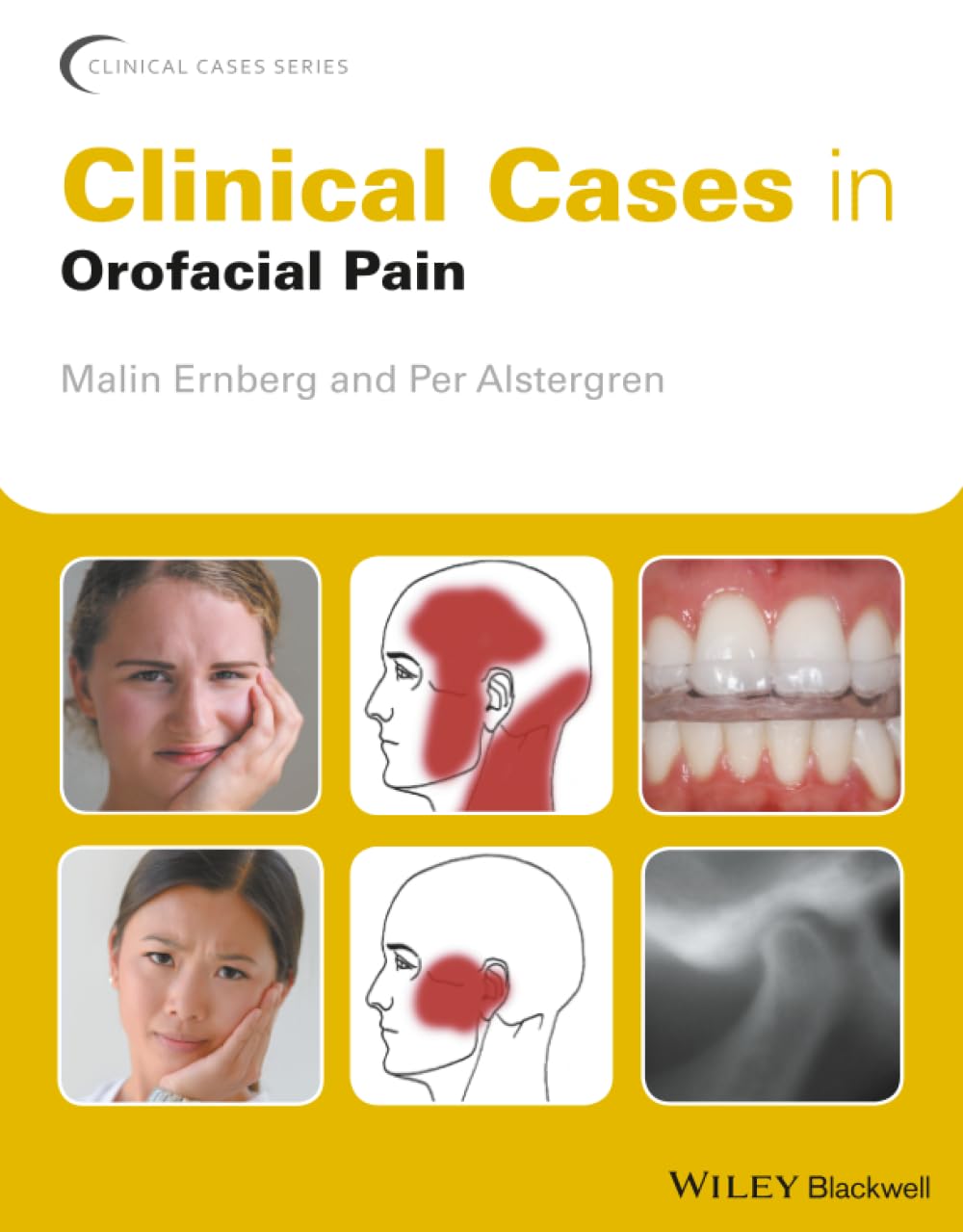 Clinical Cases in Orofacial Pain book