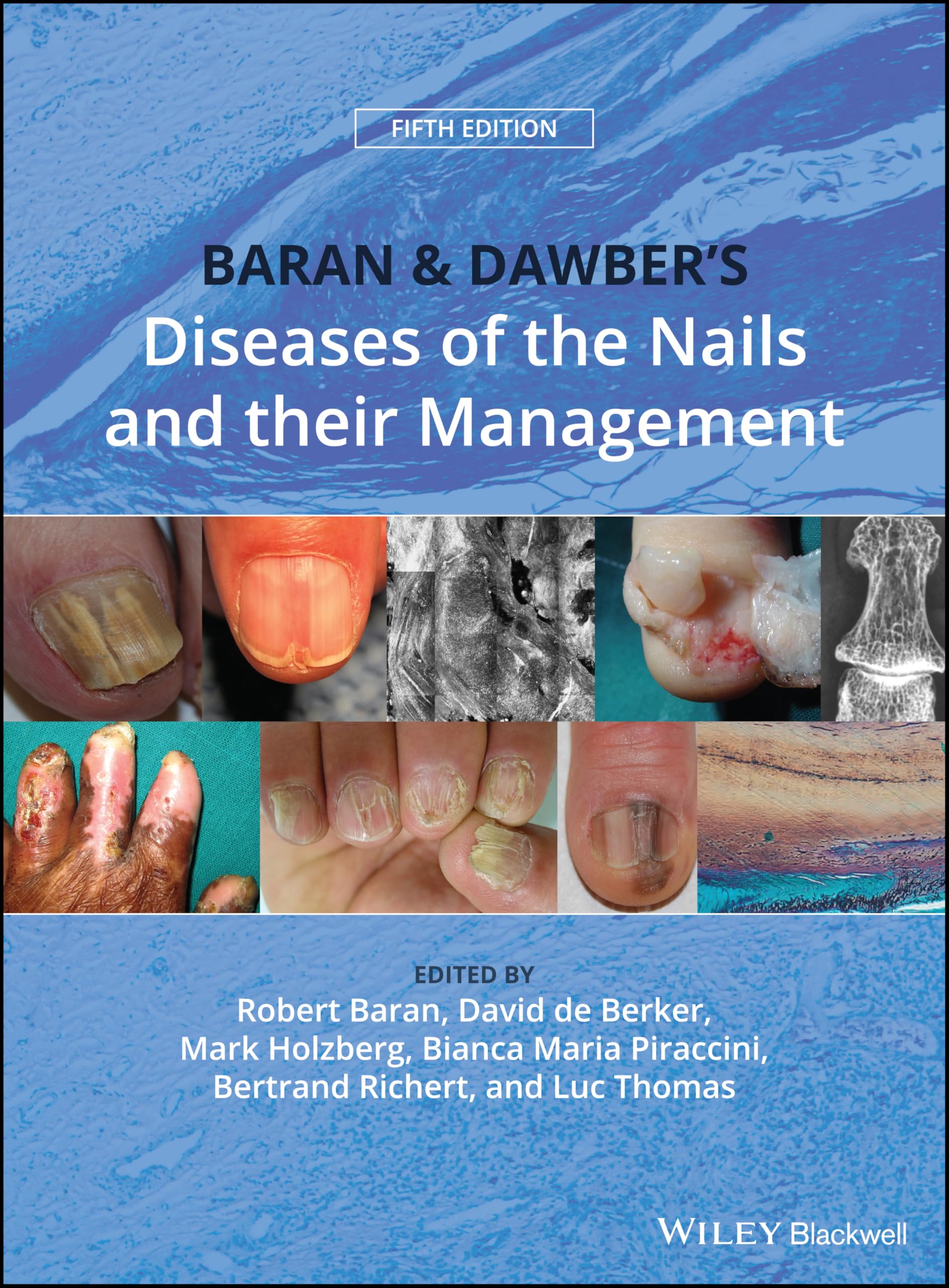 Baran and Dawber's Diseases of the Nails and their Management Medicine