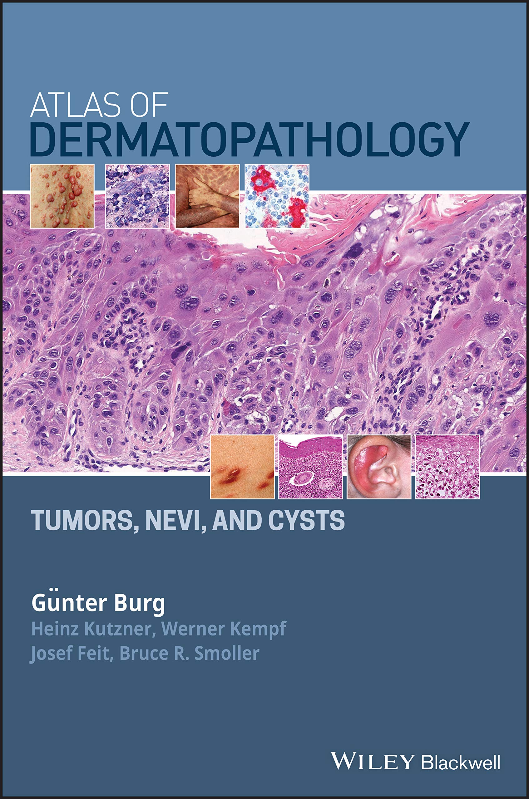 Atlas of Dermatopathology: Tumors, Nevi, and Cysts Medicine