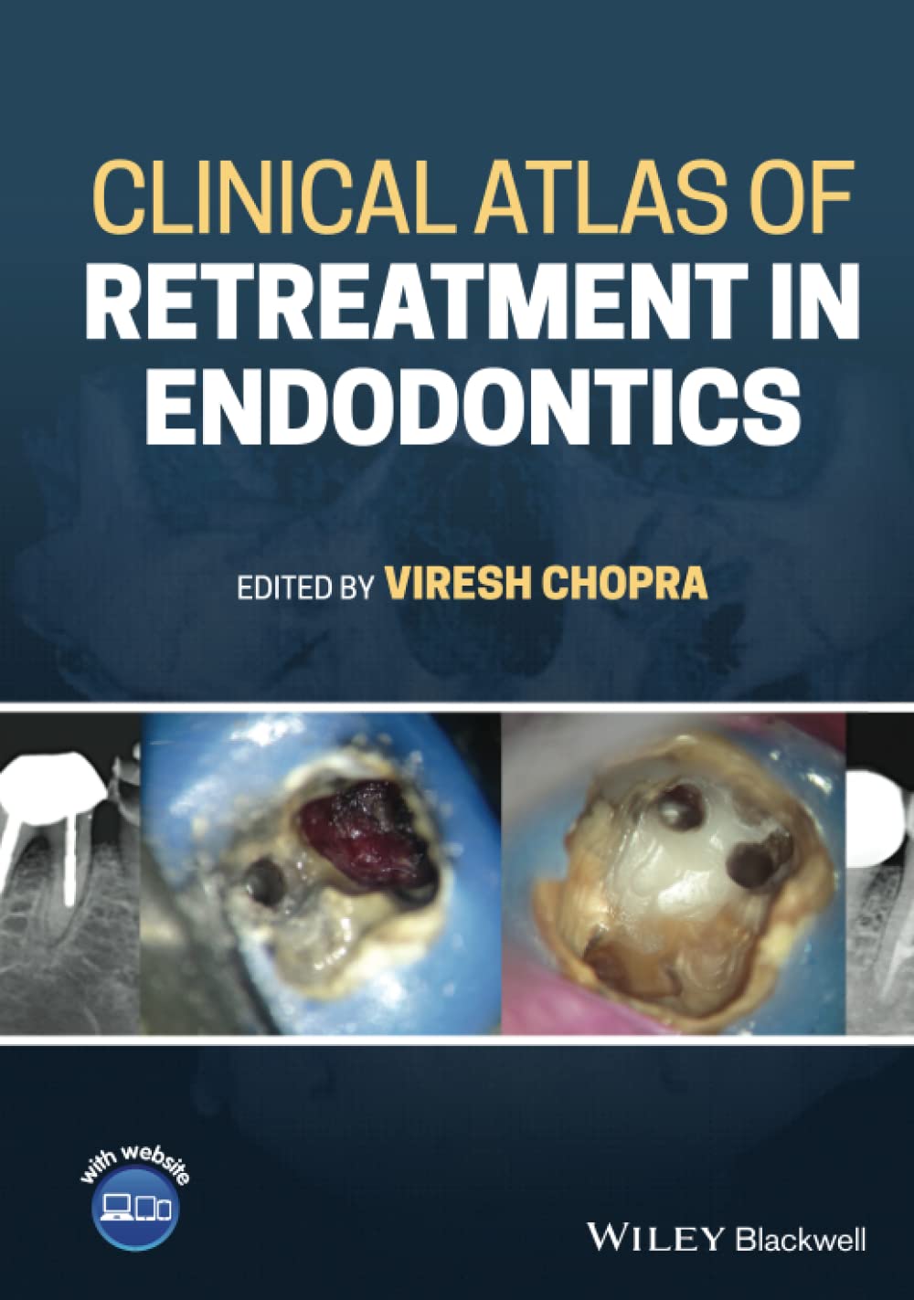 Clinical Atlas of Retreatment in Endodontics: Includes Website Medicine