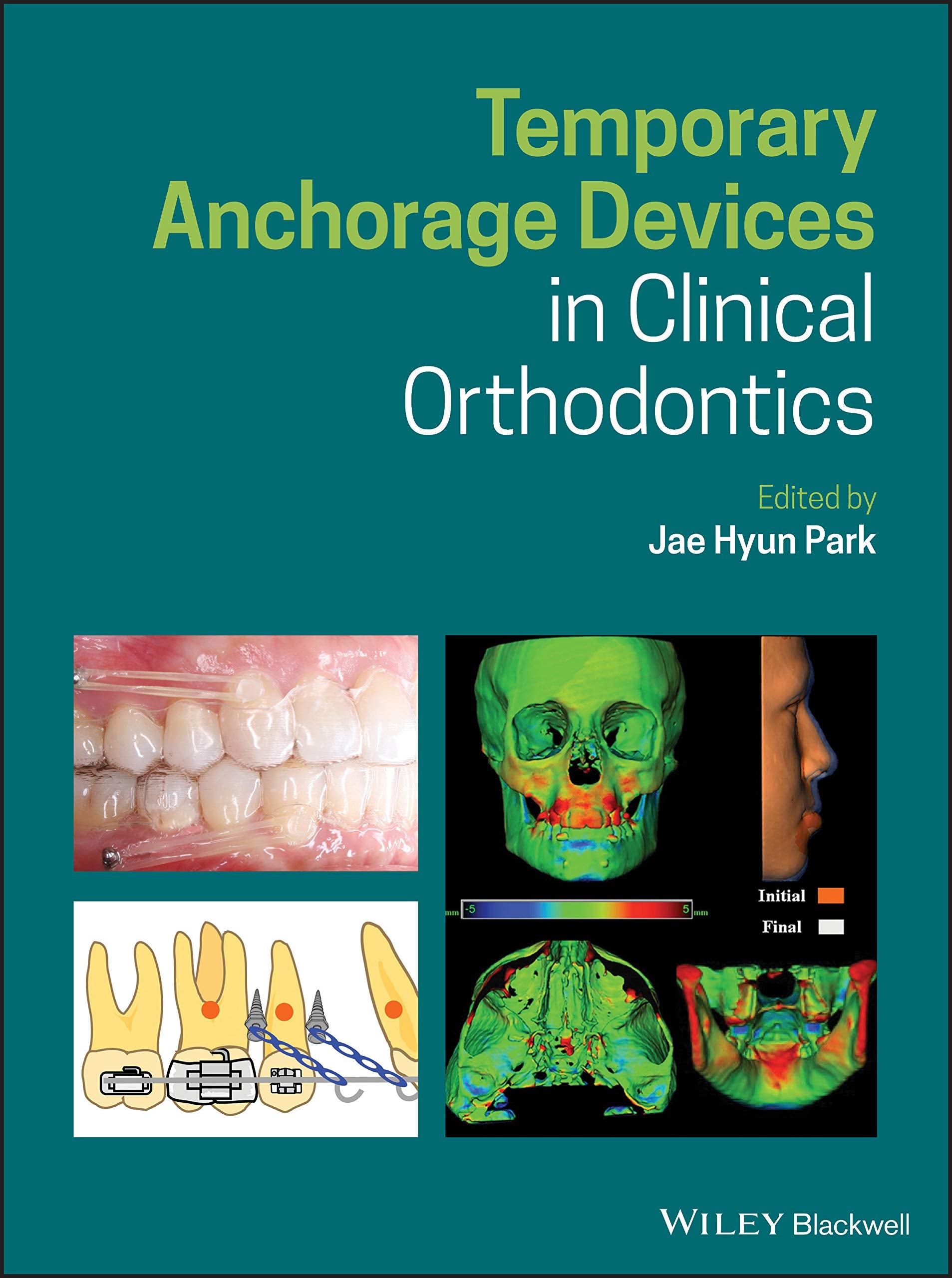 Temporary Anchorage Devices in Clinical Orthodontics Medicine