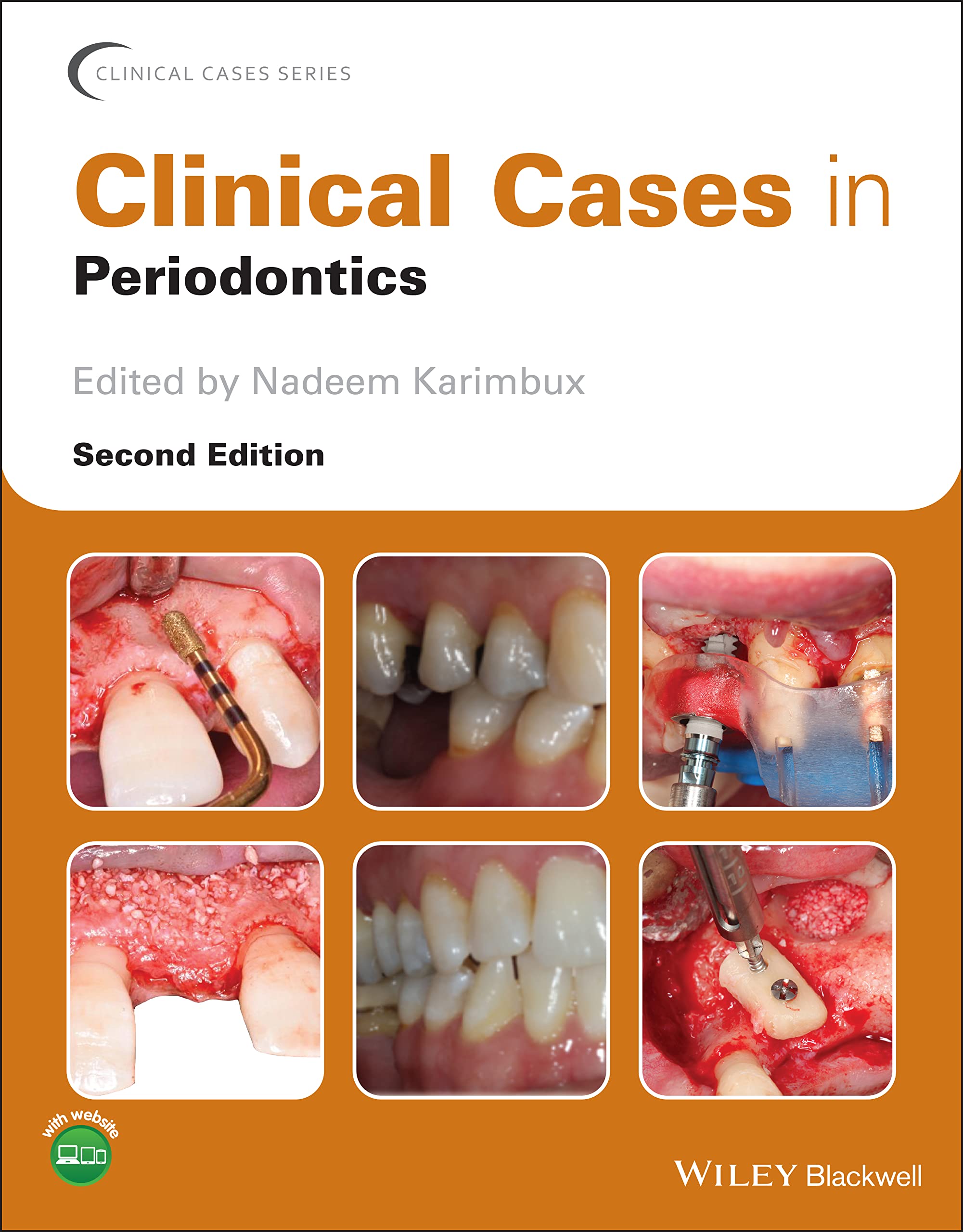 Clinical Cases in Periodontics (Clinical Cases (Dentistry)) Medicine