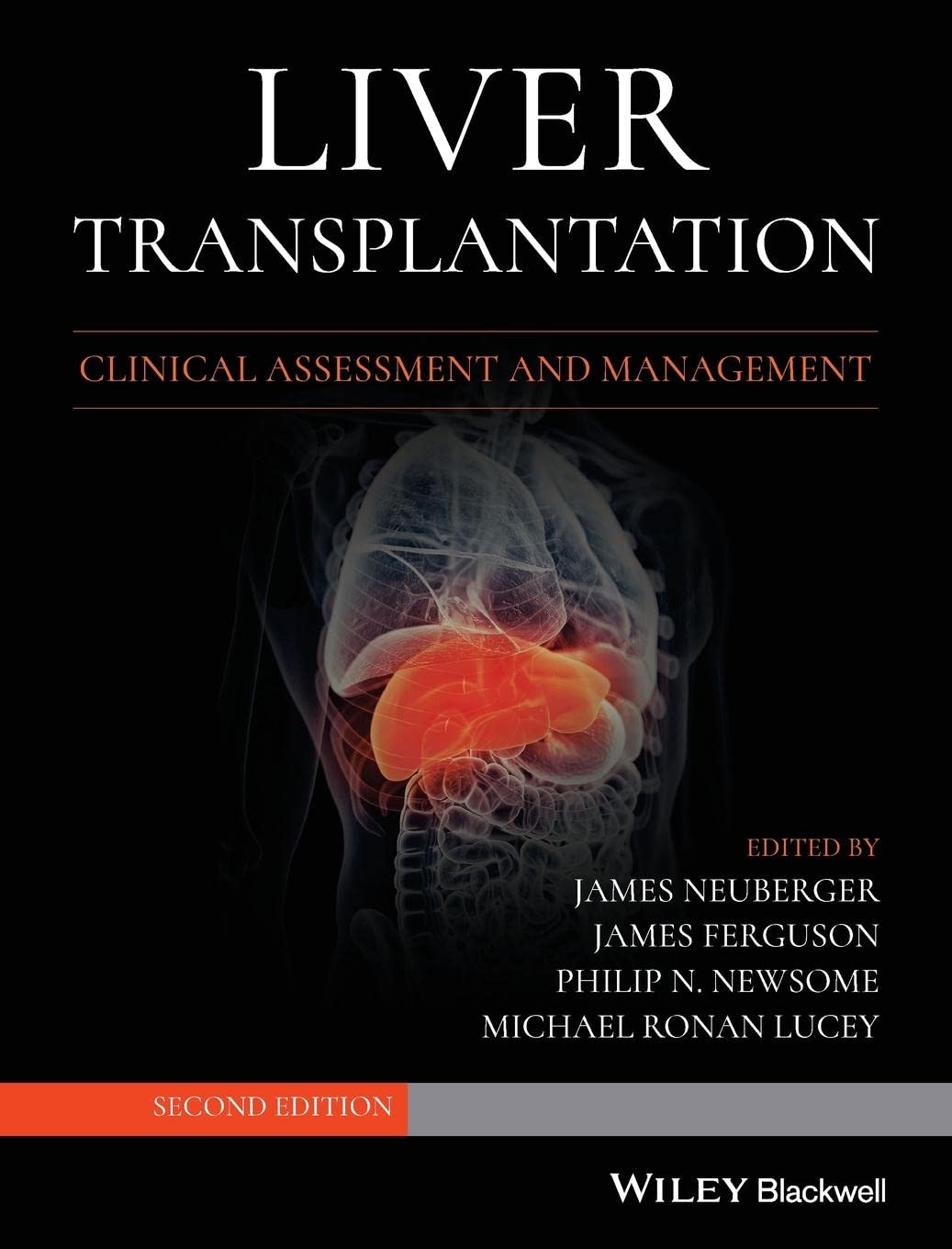 Liver Transplantation: Clinical Assessment and Management Medicine