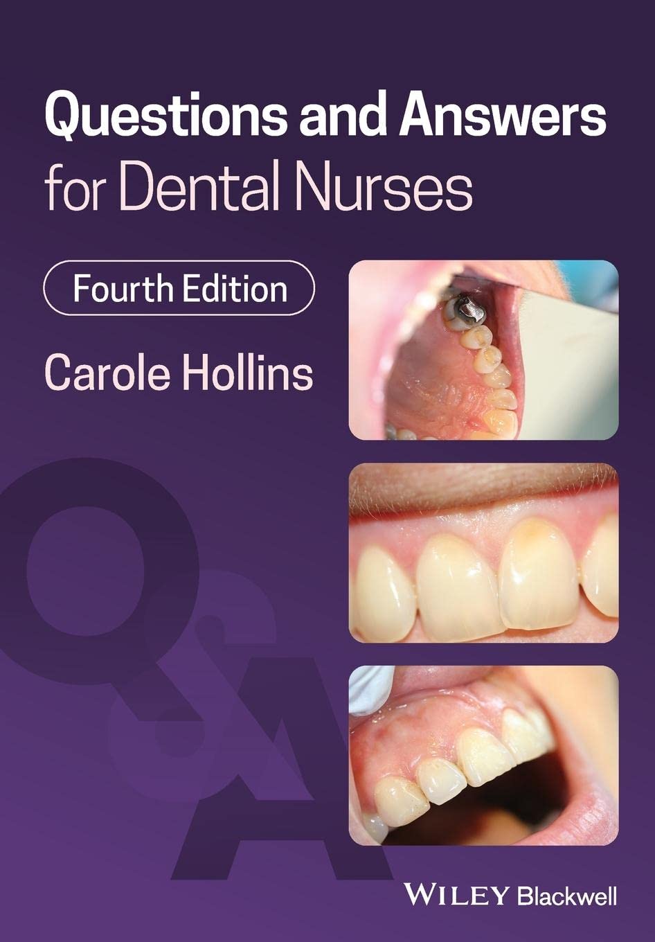 Questions and Answers for Dental Nurses book