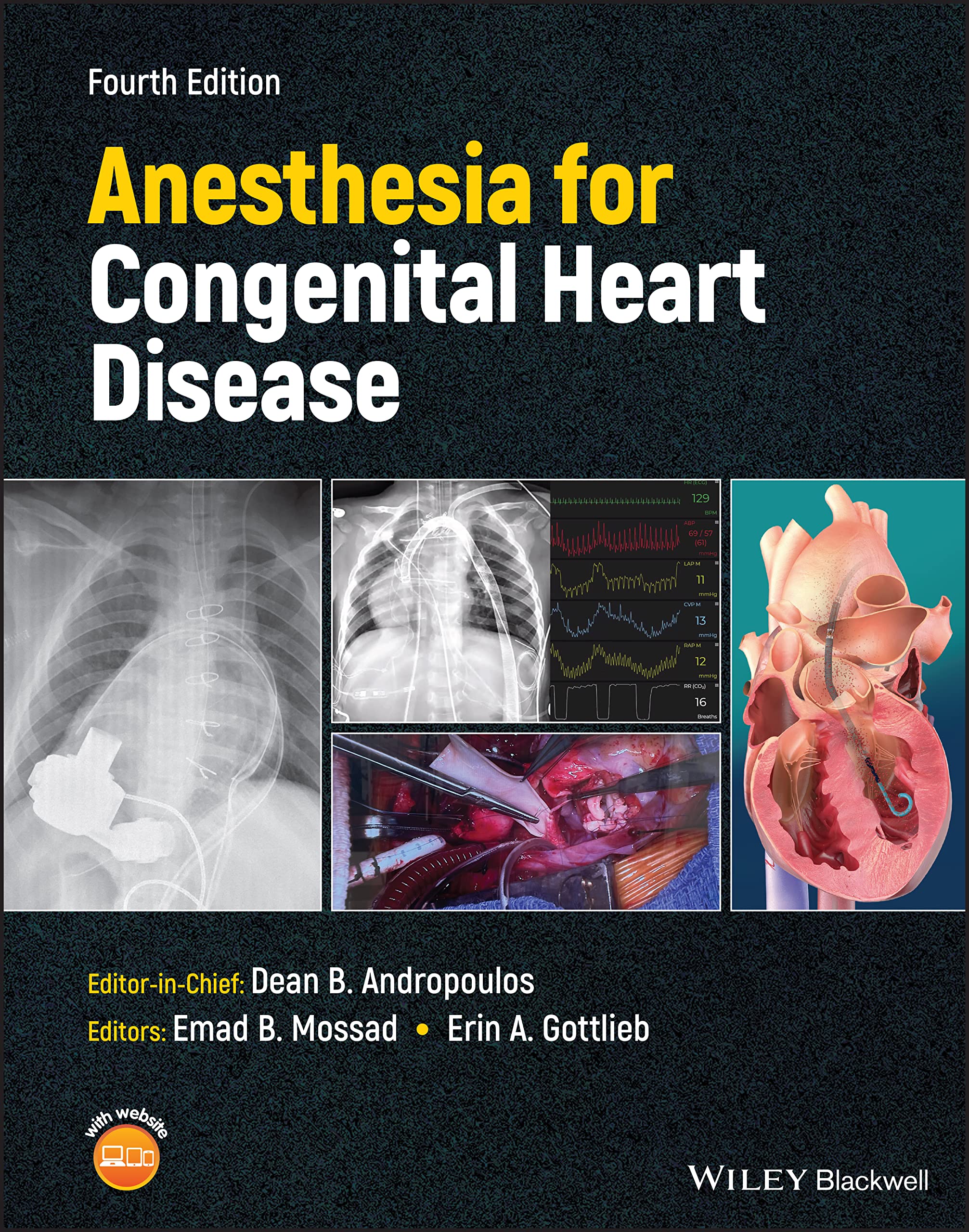 Anesthesia for Congenital Heart Disease Medicine