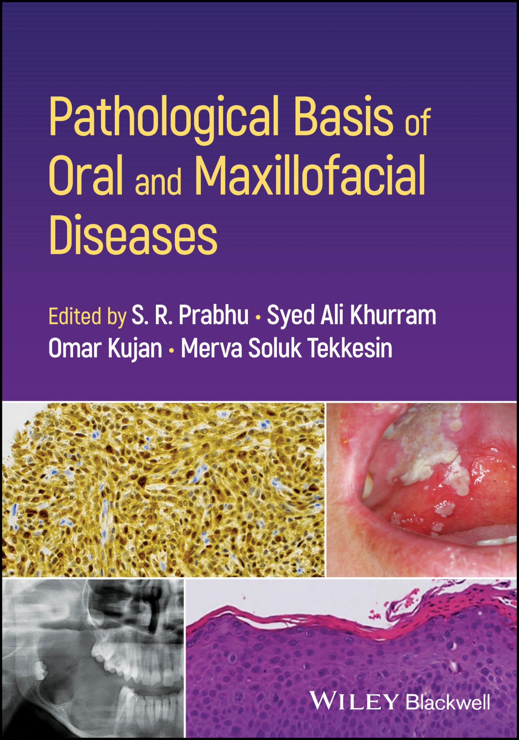Pathological Basis of Oral and Maxillofacial Diseases Medicine