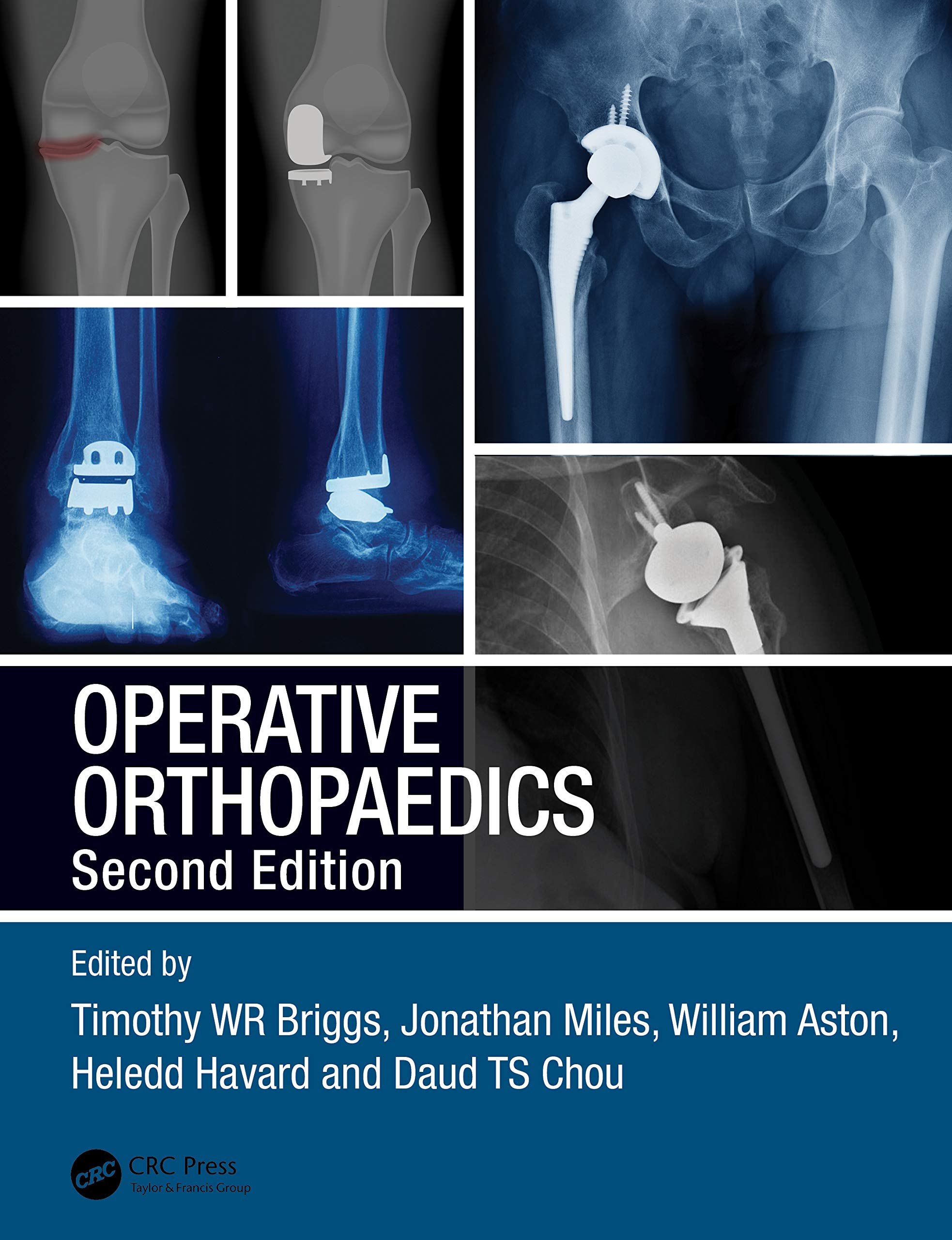 Product Image: Operative Orthopaedics: The Stanmore Guide