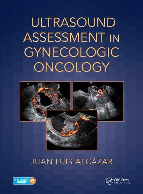 Ultrasound Assessment in Gynecologic Oncology Medicine