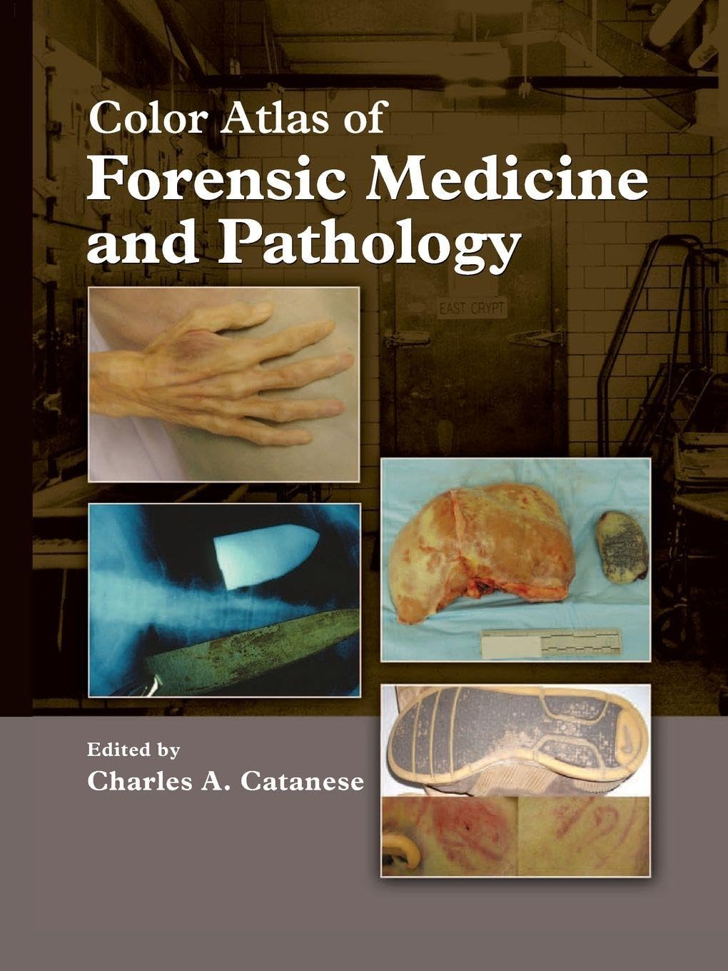 Color Atlas of Forensic Medicine and Pathology Medicine
