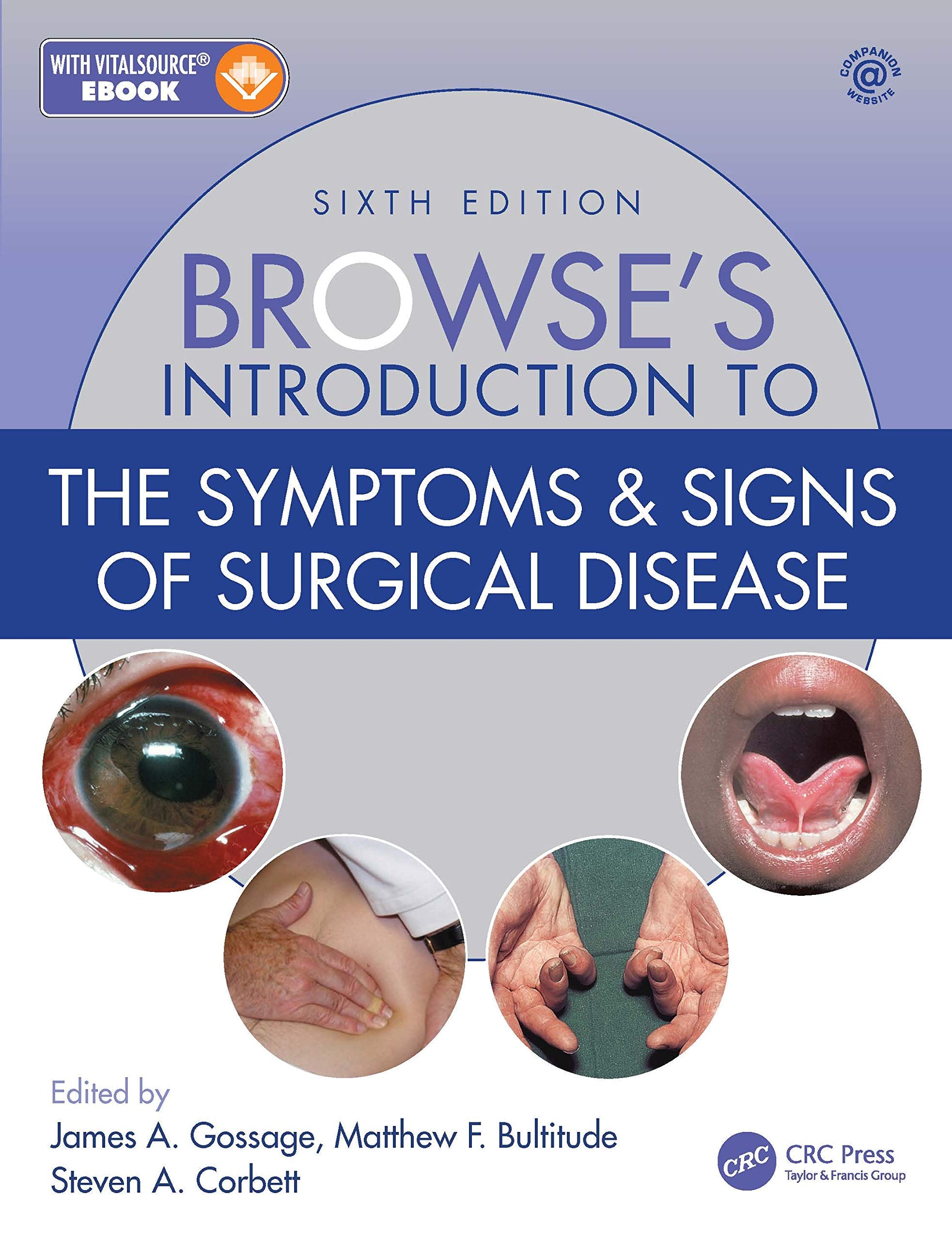 Browse's Introduction to the Symptoms & Signs of Surgical Disease: Companion Website Included Medicine