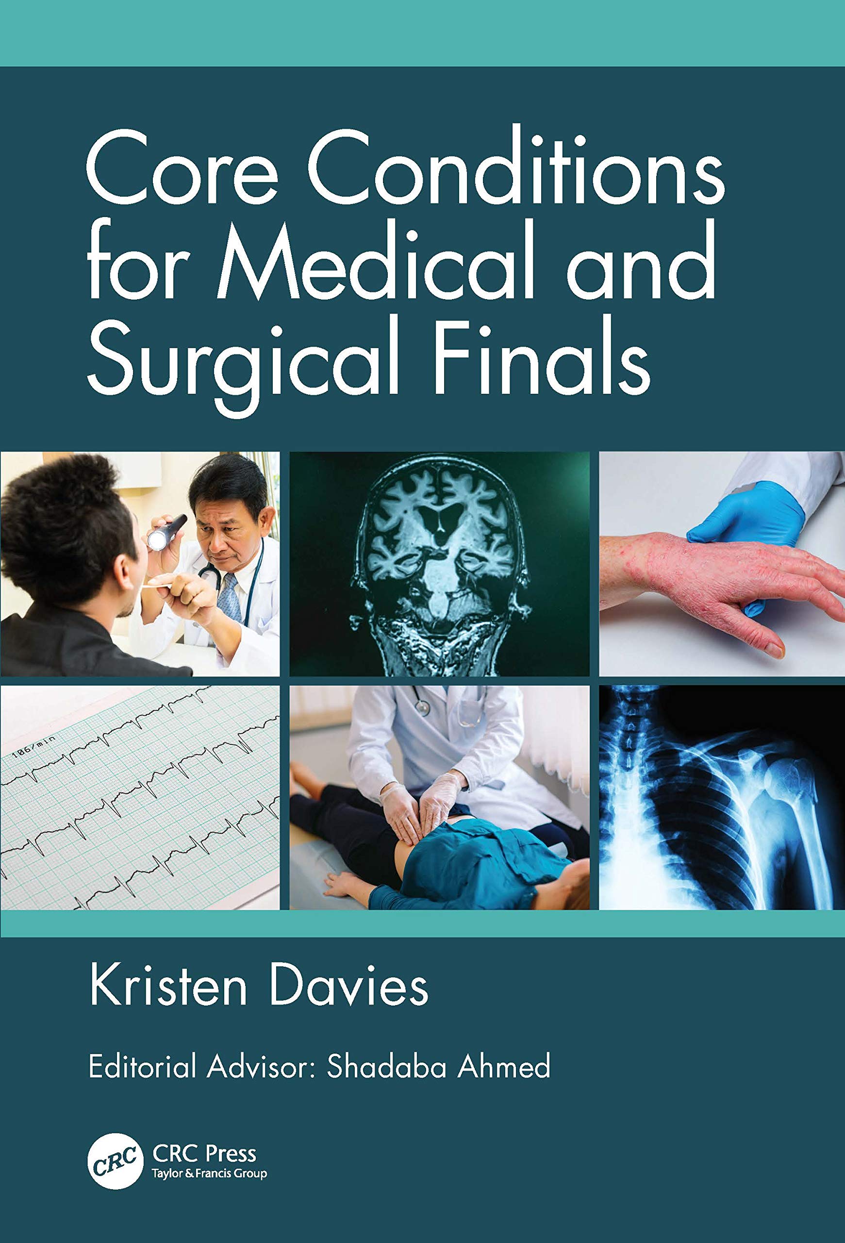 Core Conditions for Medical and Surgical Finals Medicine