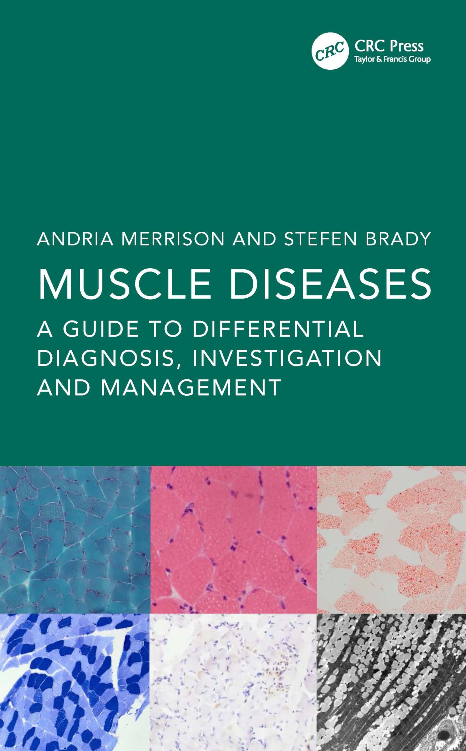 Muscle Diseases: A Guide to Differential Diagnosis, Investigation and Management Medicine