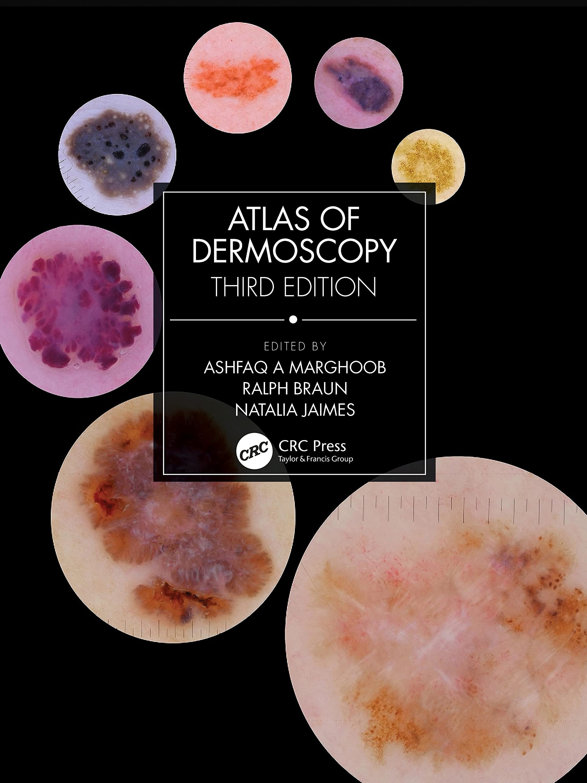 Atlas of Dermoscopy: Third Edition Medicine
