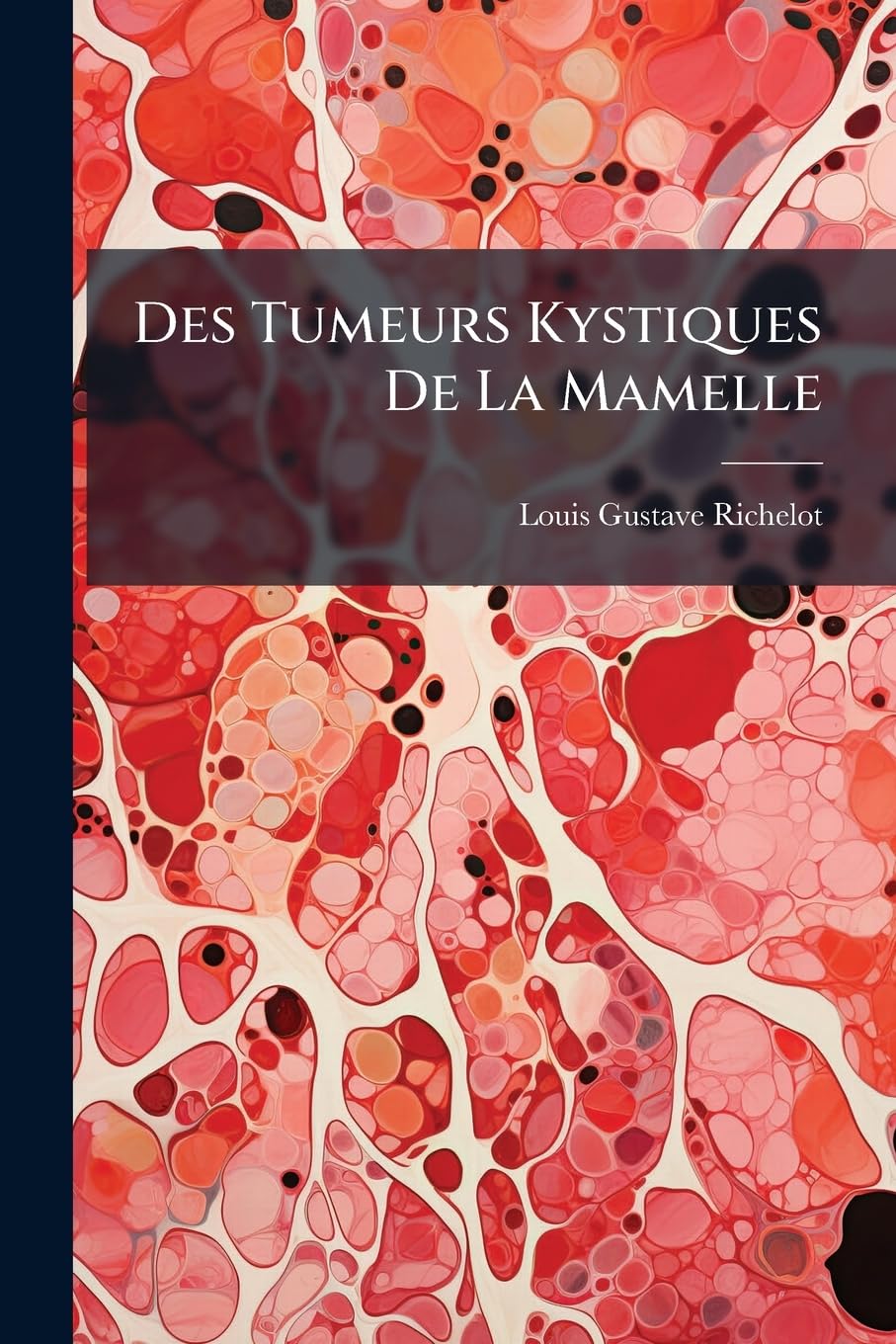 Des Tumeurs Kystiques de la Mamelle book
