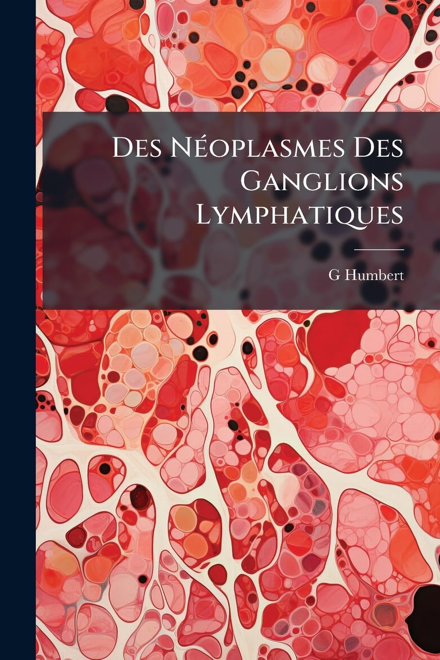 Des Néoplasmes Des Ganglions Lymphatiques book