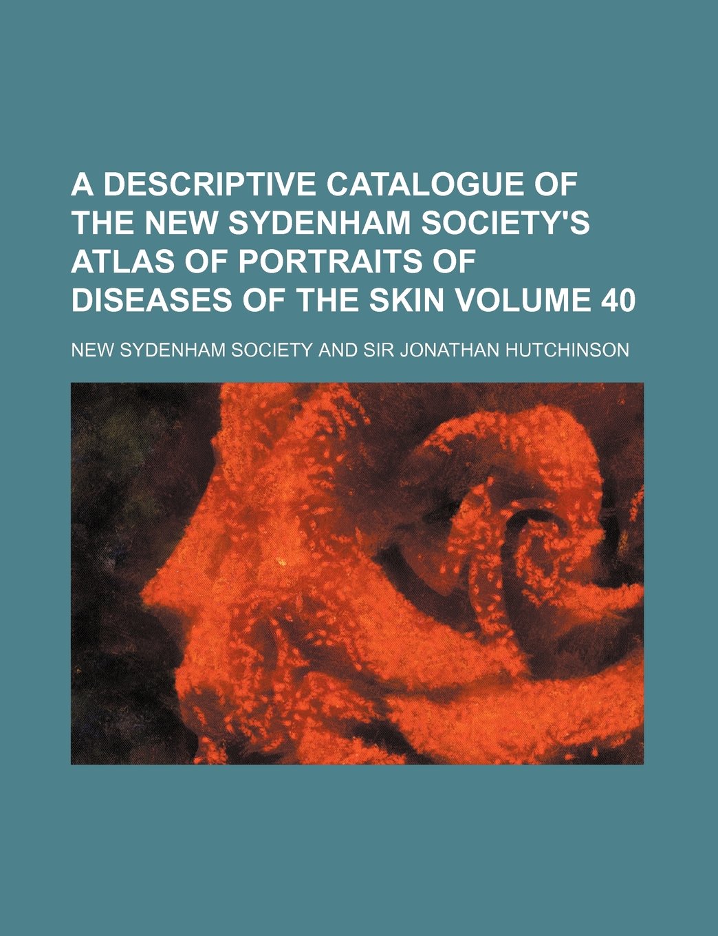 A Descriptive Catalogue of the New Sydenham Society's Atlas of Portraits of Diseases of the Skin Volume 40 Books