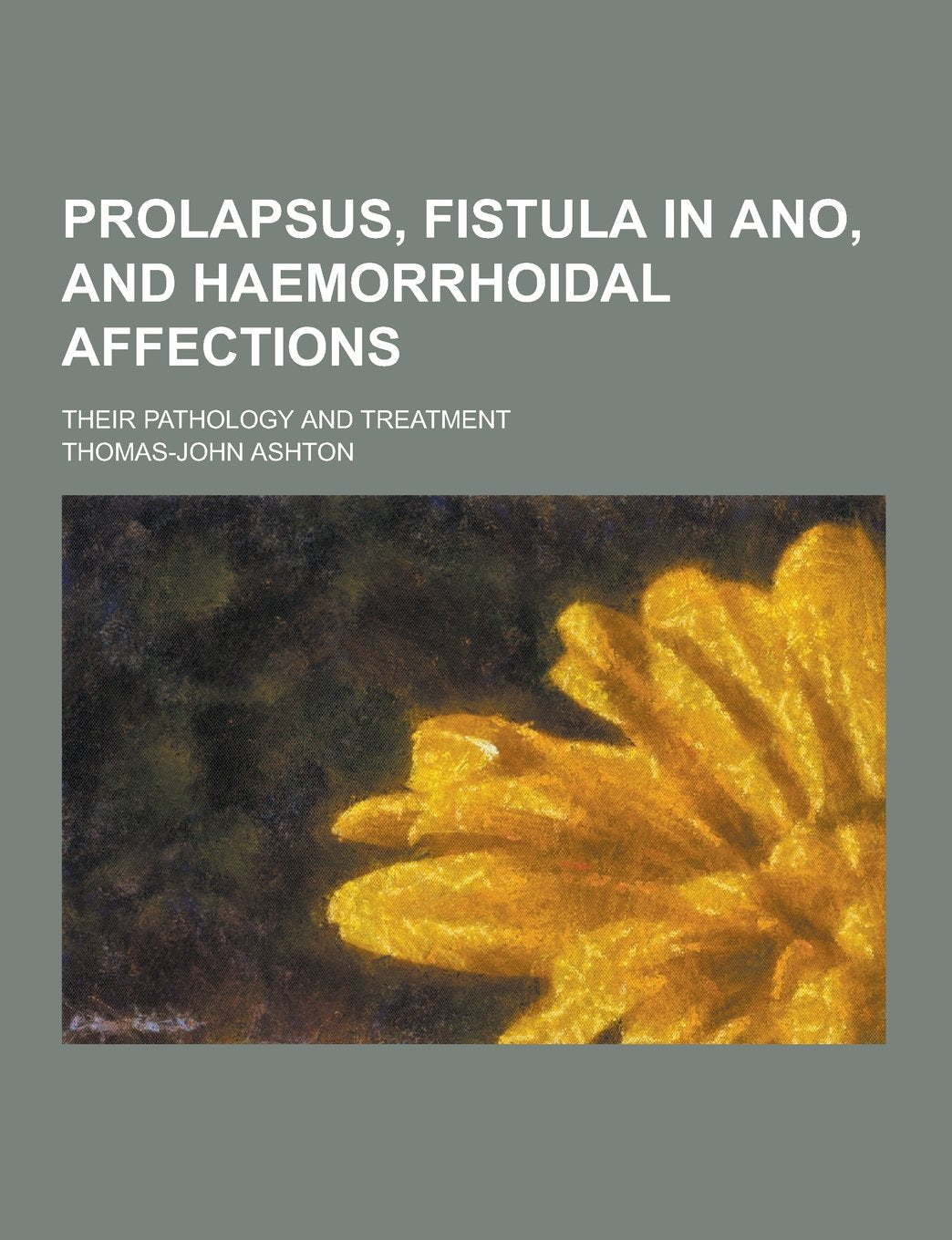 Prolapsus, Fistula in Ano, and Haemorrhoidal Affections; Their Pathology and Treatment Books