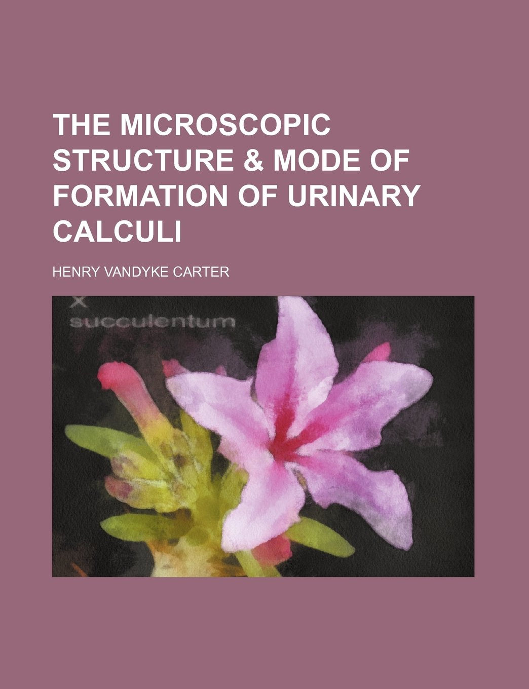 The Microscopic Structure & Mode of Formation of Urinary Calculi Medicine