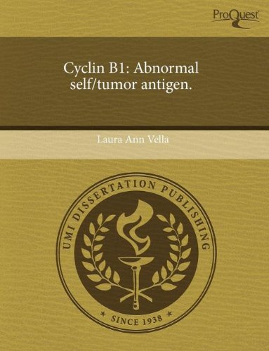 Cyclin B1: Abnormal Self/Tumor Antigen Social Sciences