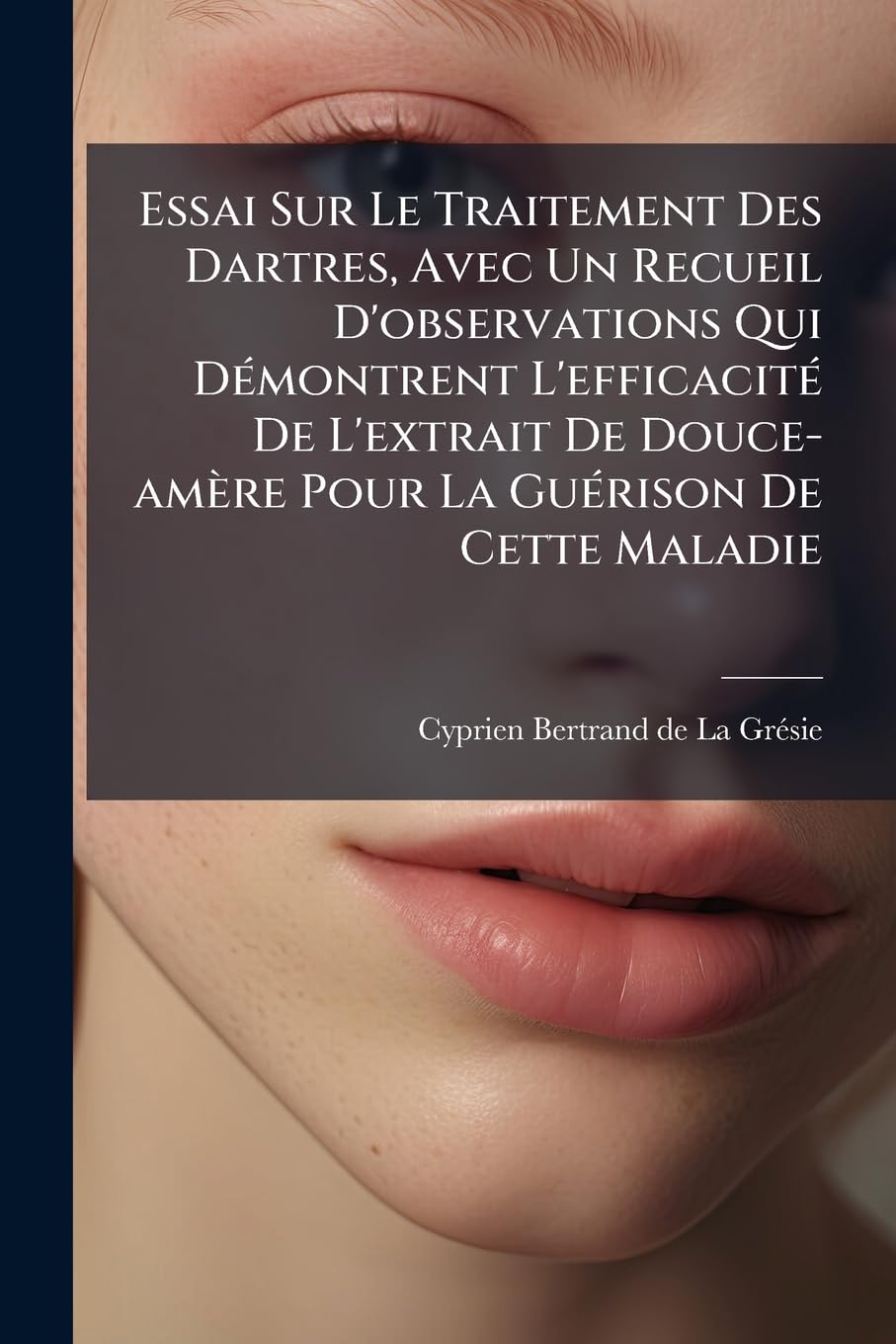 Essai Sur Le Traitement Des Dartres, Avec Un Recueil D'observations Qui Démontrent L'efficacité De L'extrait De Douce-amère Pour La Guérison De Cette Maladie book
