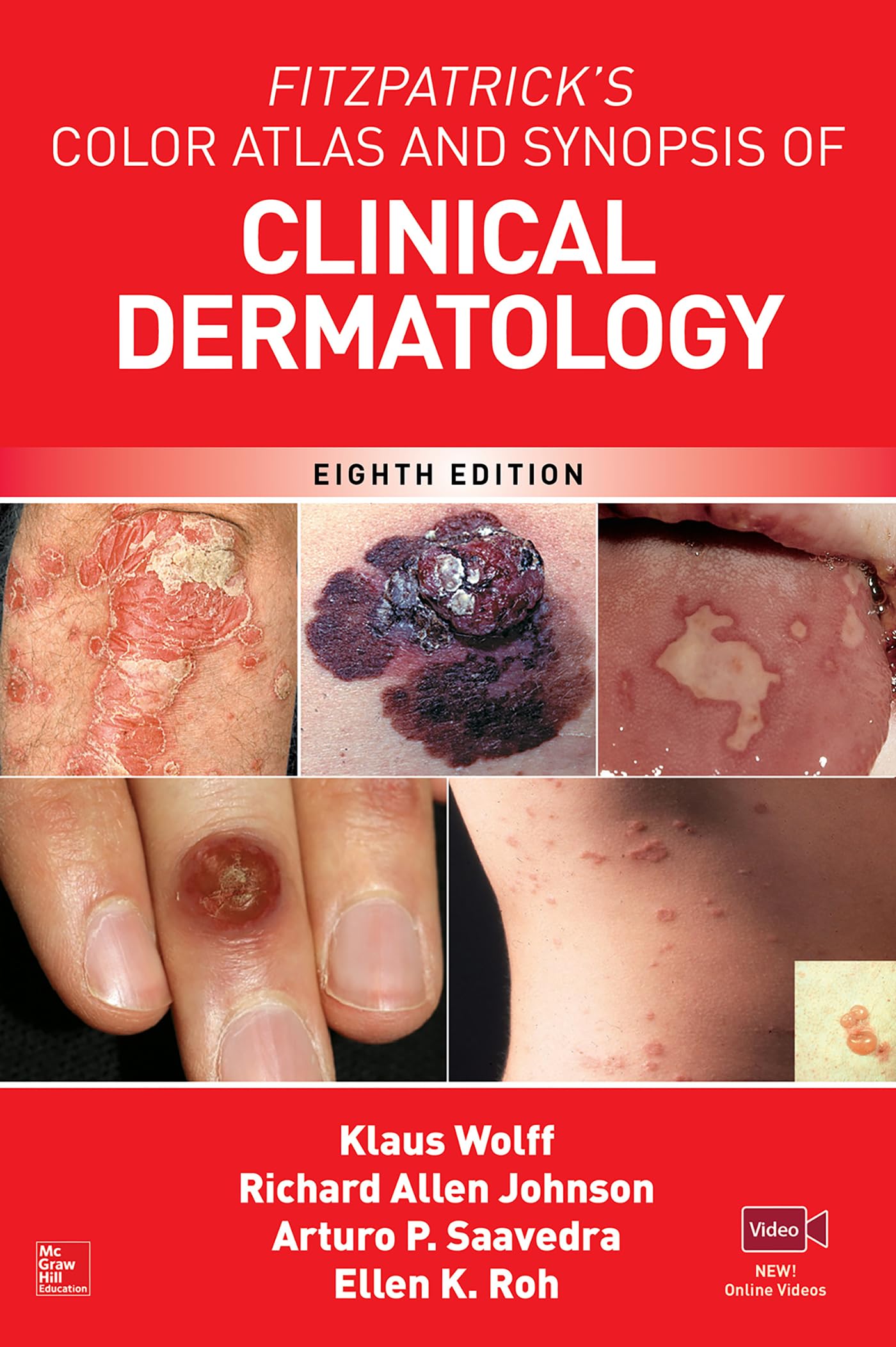 Fitzpatrick's Color Atlas and Synopsis of Clinical Dermatology (Medicina) Medicine