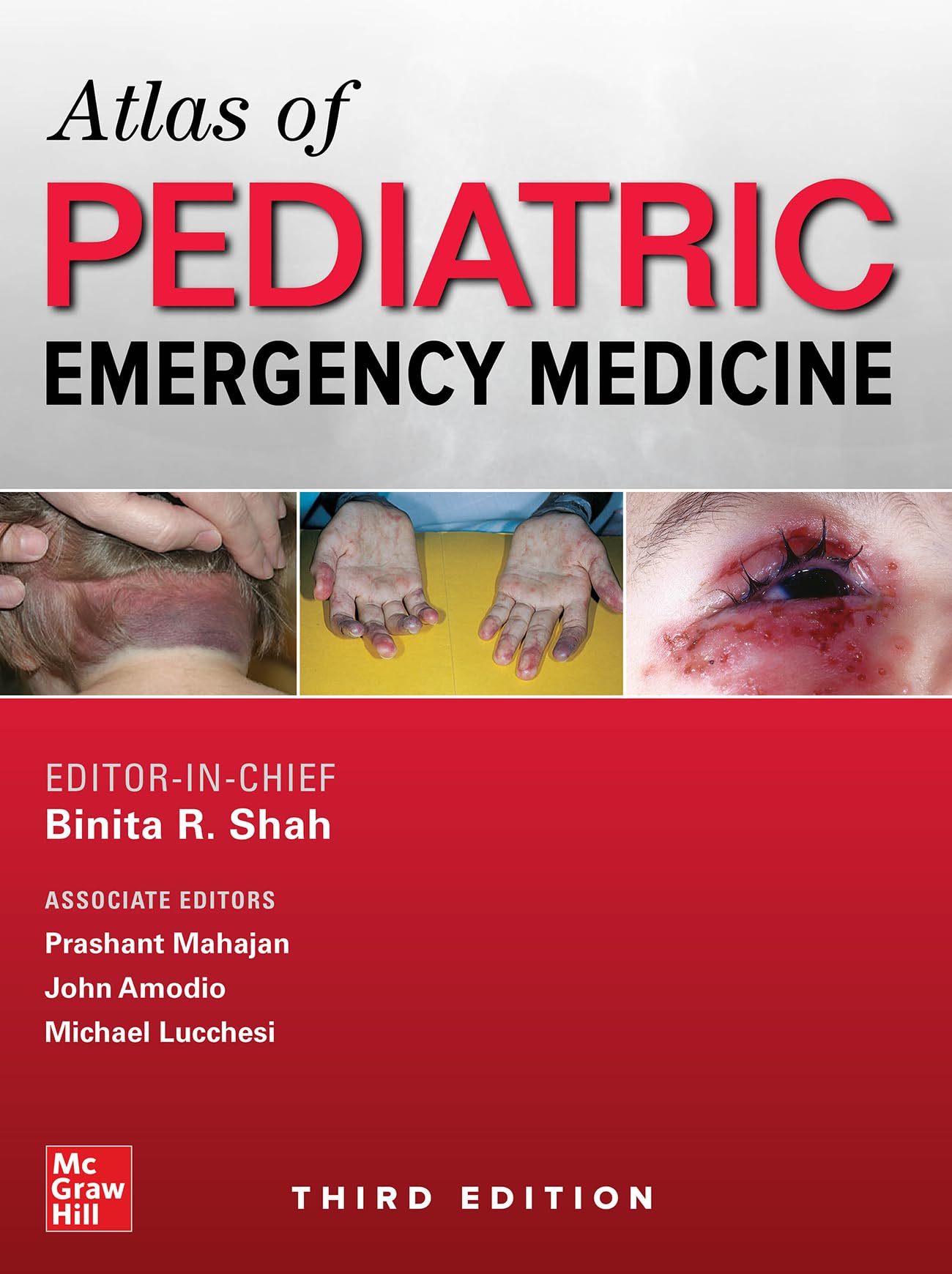 Atlas of Pediatric Emergency Medicine, Third Edition Medicine