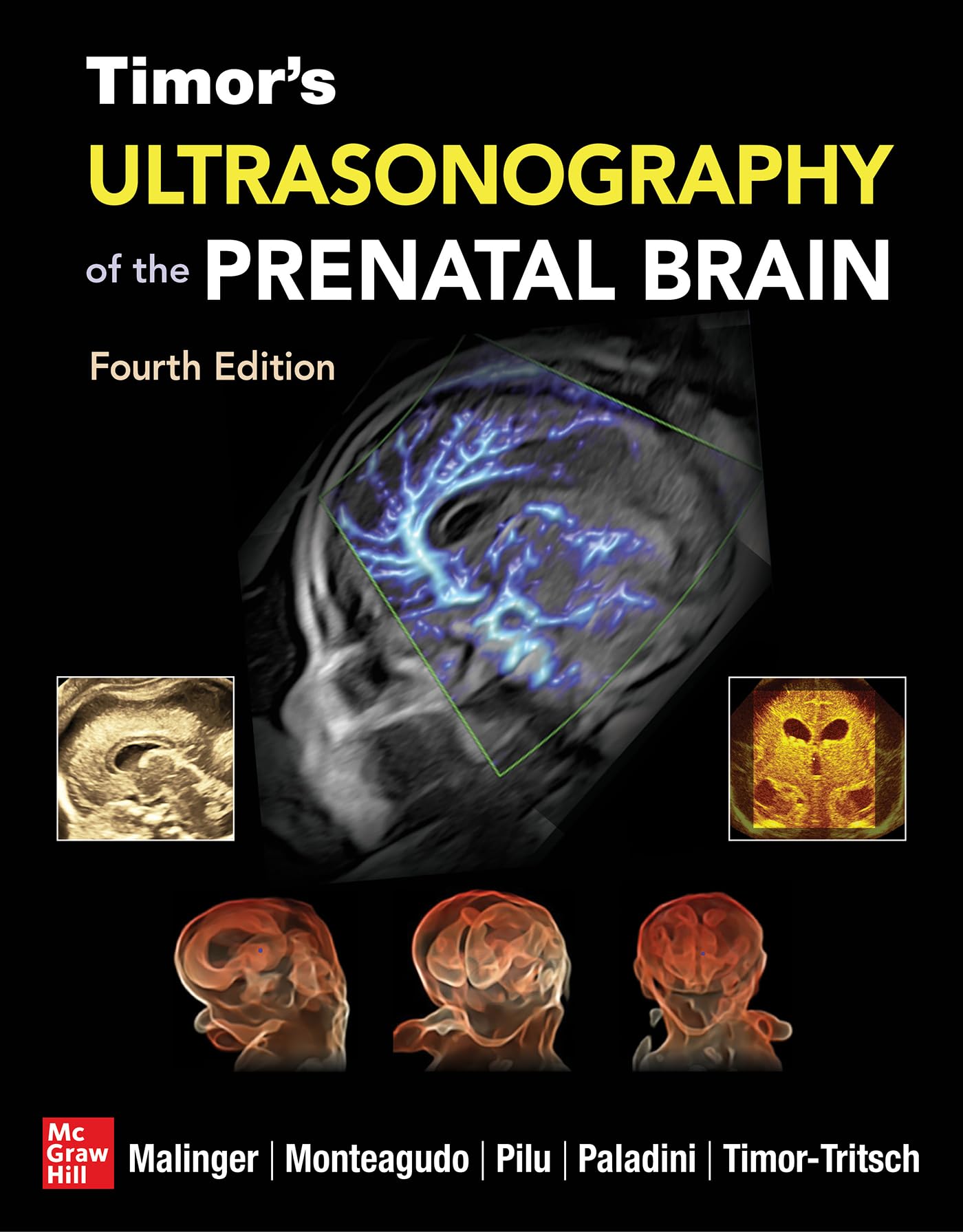 Timor's Ultrasonography of the Prenatal Brain (Medicina) Medicine
