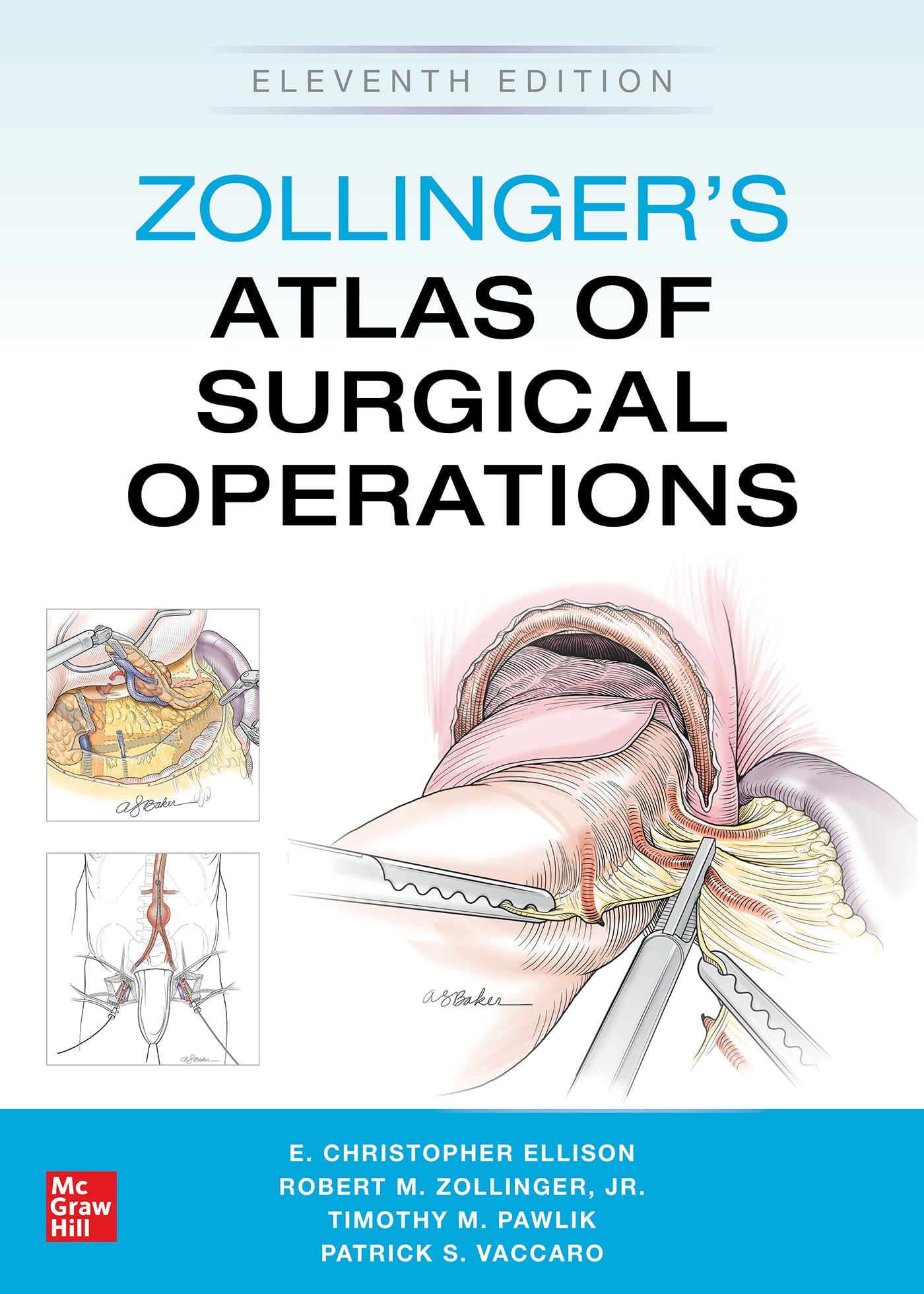 Zollinger's Atlas of Surgical Operations Medicine