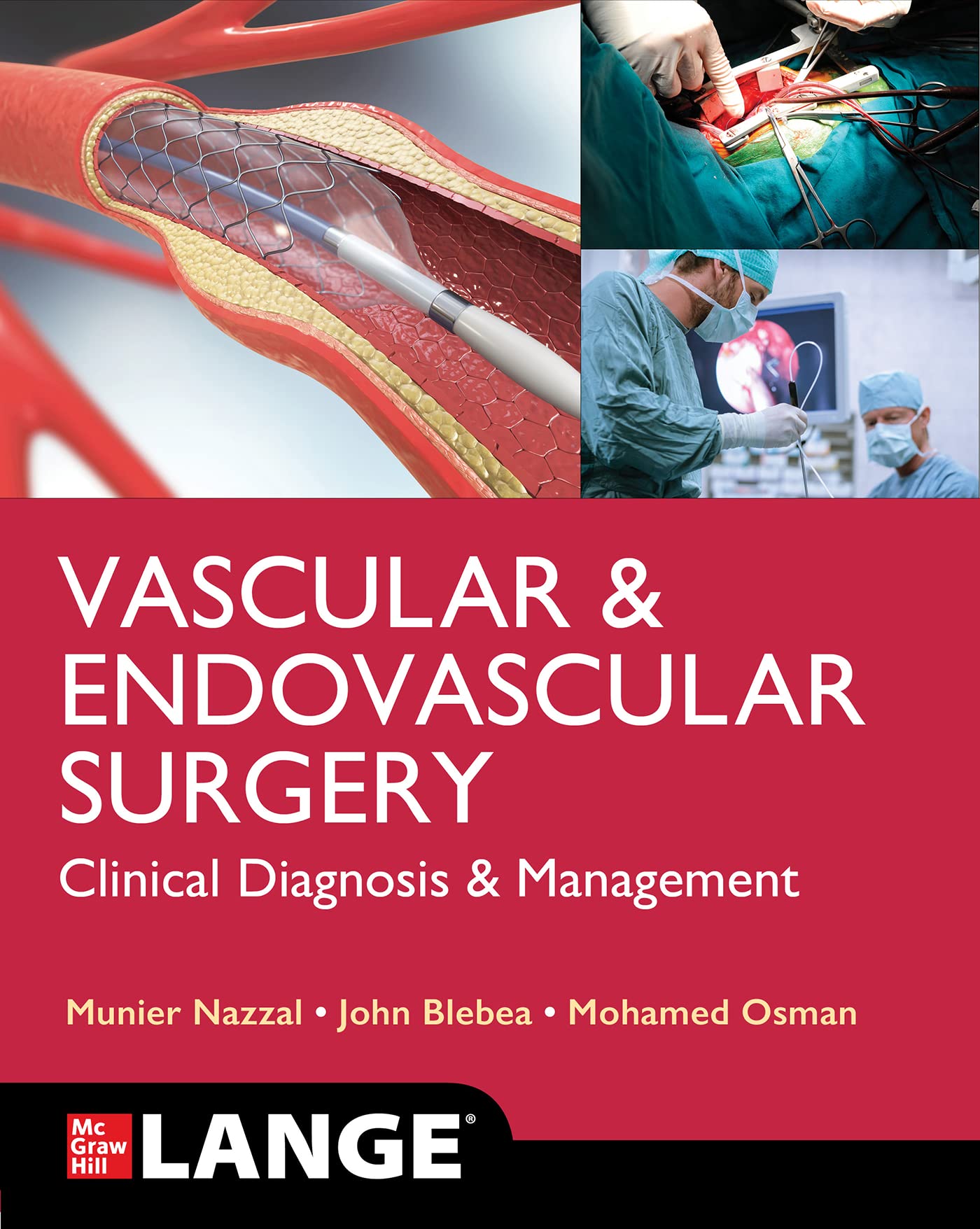 Lange Vascular and Endovascular Surgery: Clinical Diagnosis and Management (Lange Medical Book) Medicine