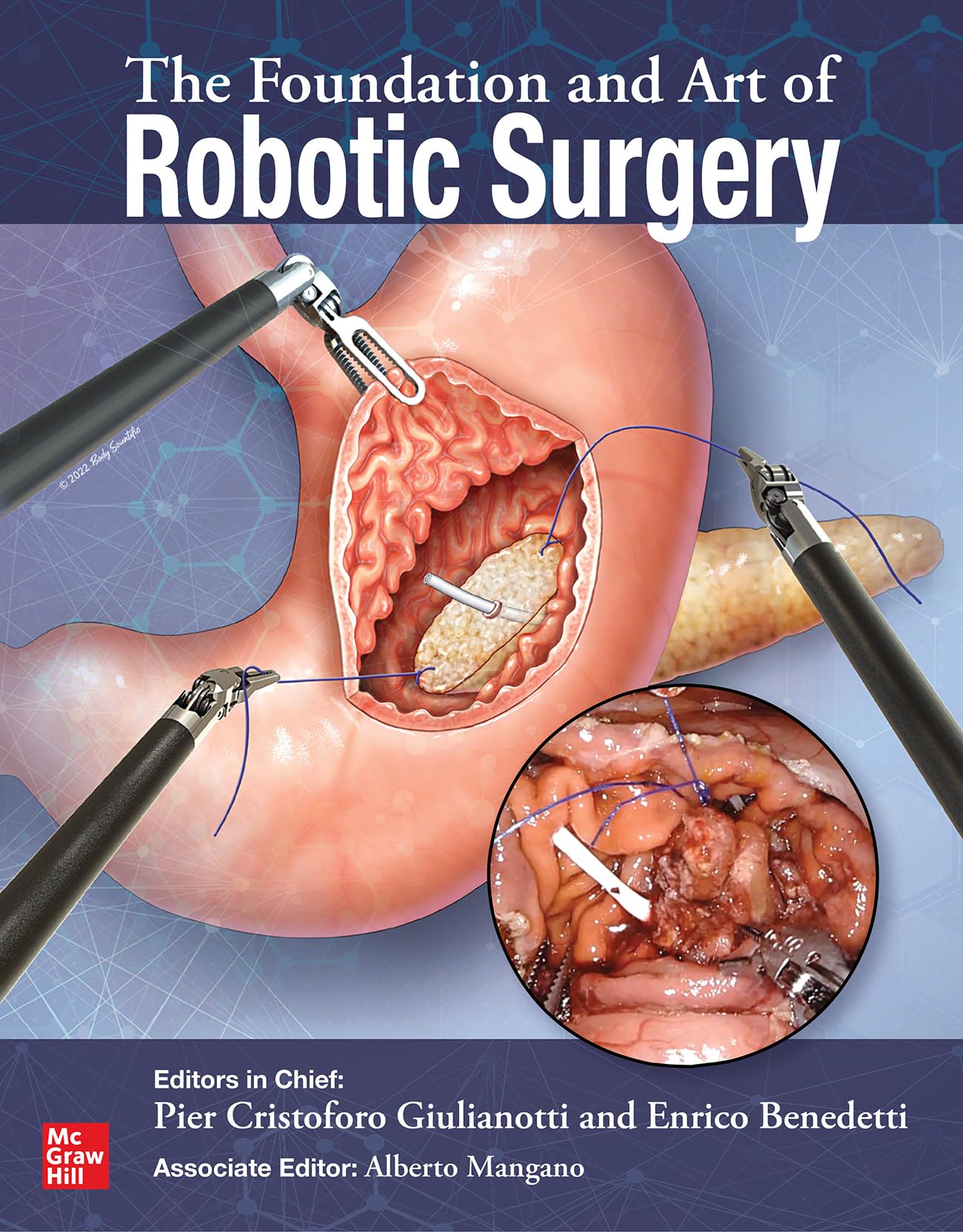 The Foundation and Art of Robotic Surgery (Medicina) Medicine