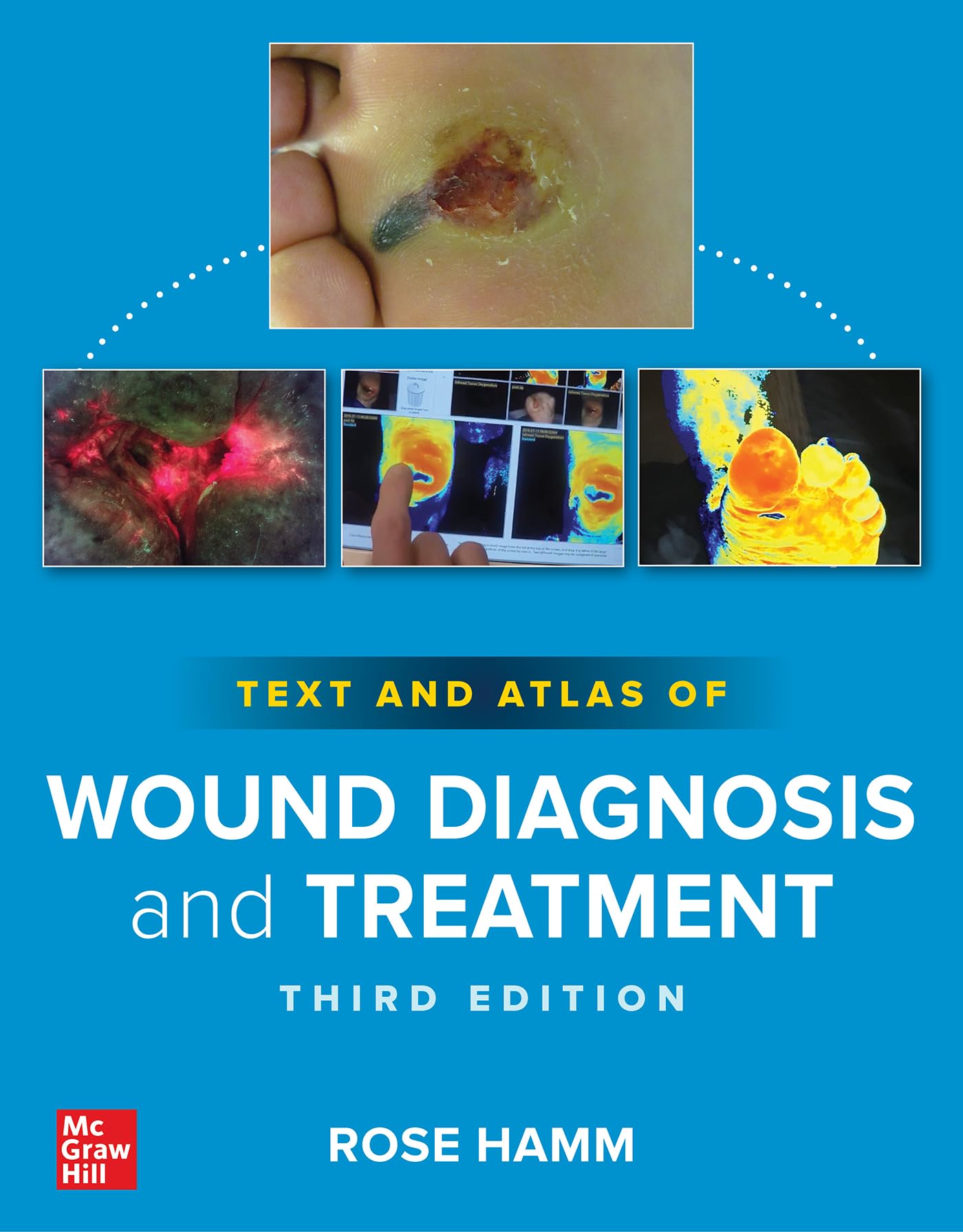Text and Atlas of Wound Diagnosis and Treatment Medicine