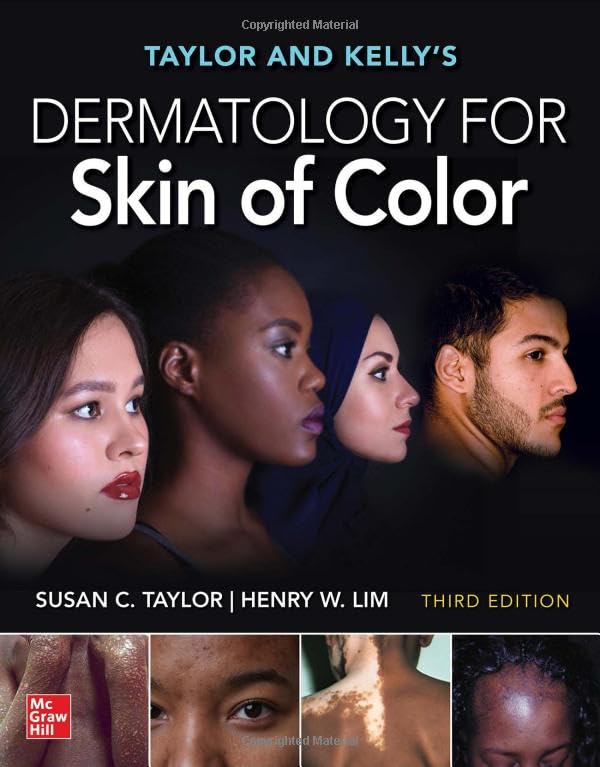 Taylor and Kelly's Dermatology for Skin of Color book