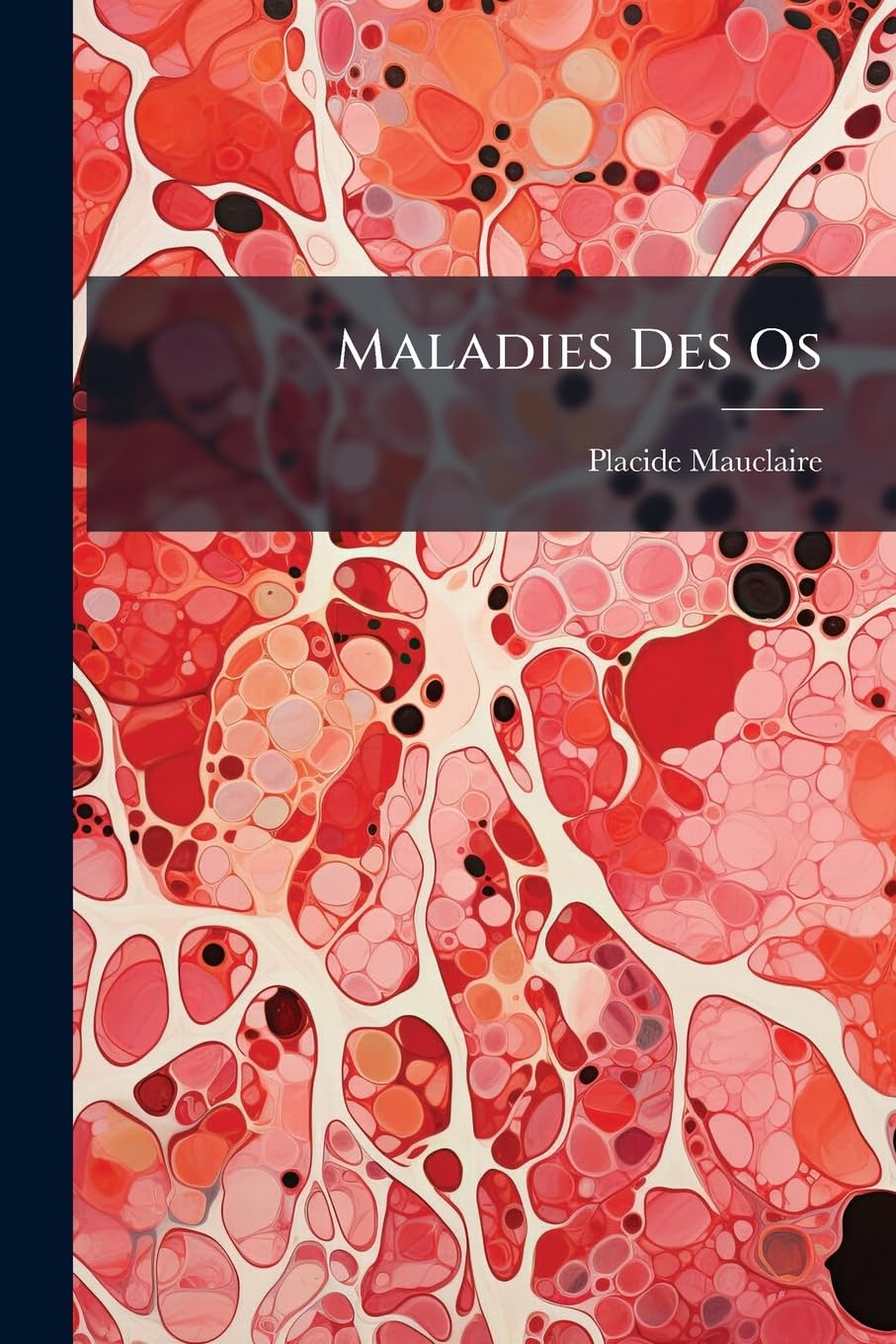 Maladies Des Os: Lésions Infectieuses, Parasitaires, Trophiques, Néoplasiques... Politics & History