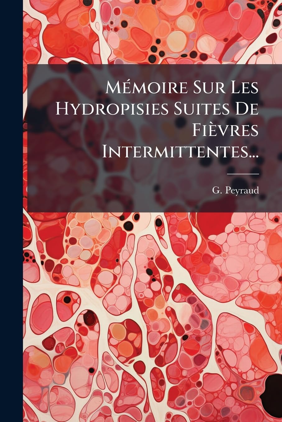 Mémoire Sur Les Hydropisies Suites de Fièvres Intermittentes... book